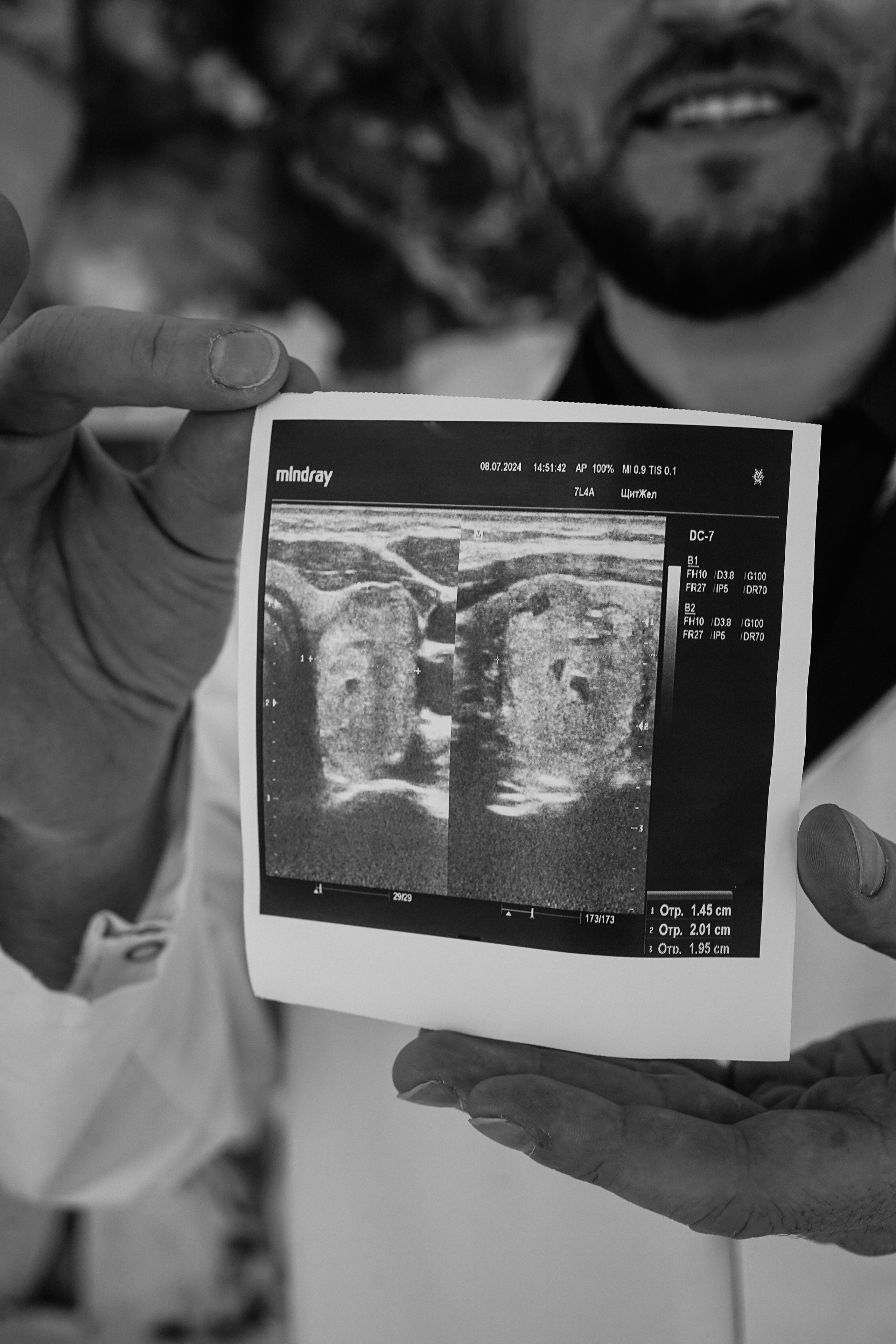 Виктор Хирург-эндокринолог. Фотограф Ольга Игорева