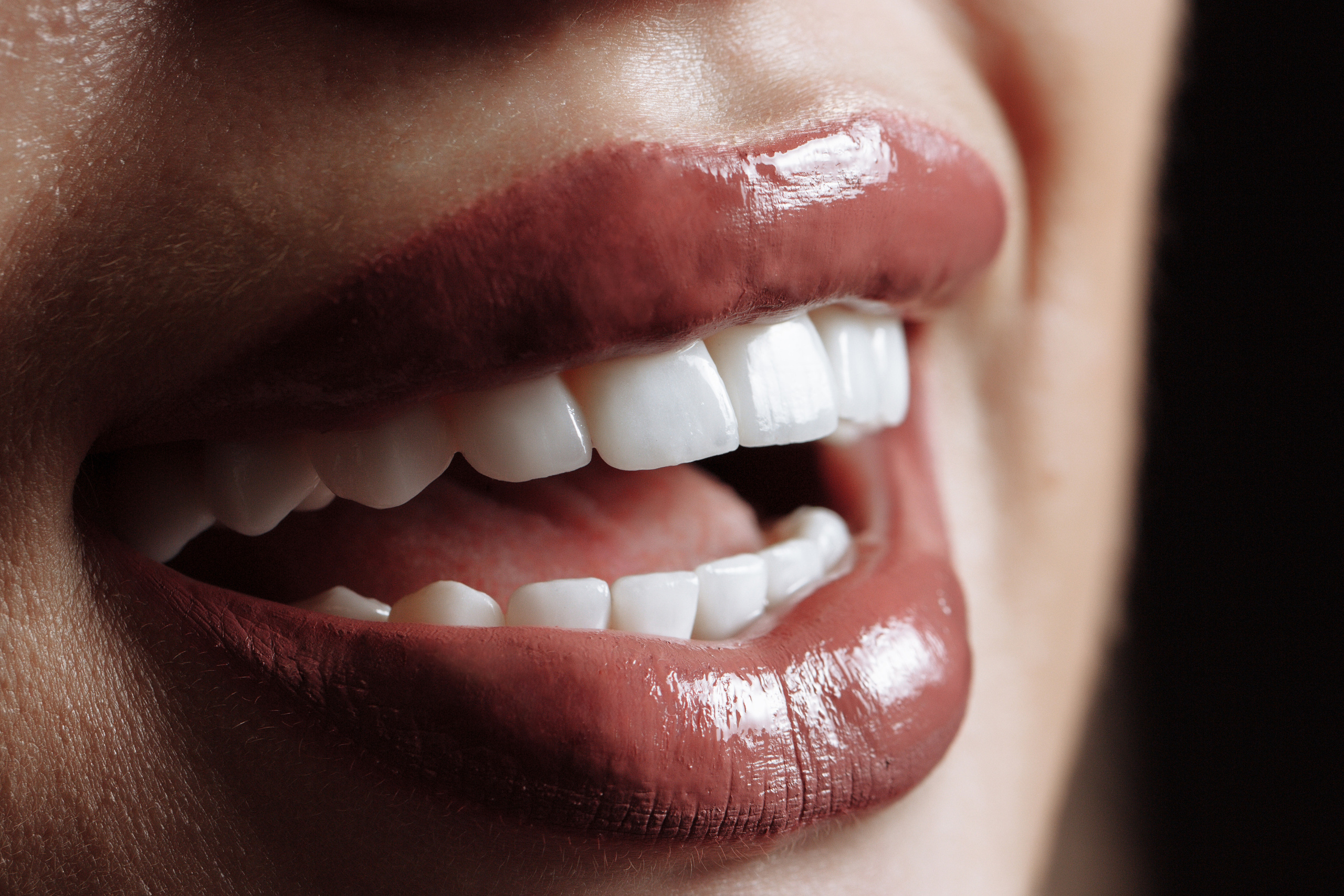 Профессиональная фото и видео съемка стоматологии. Виниры