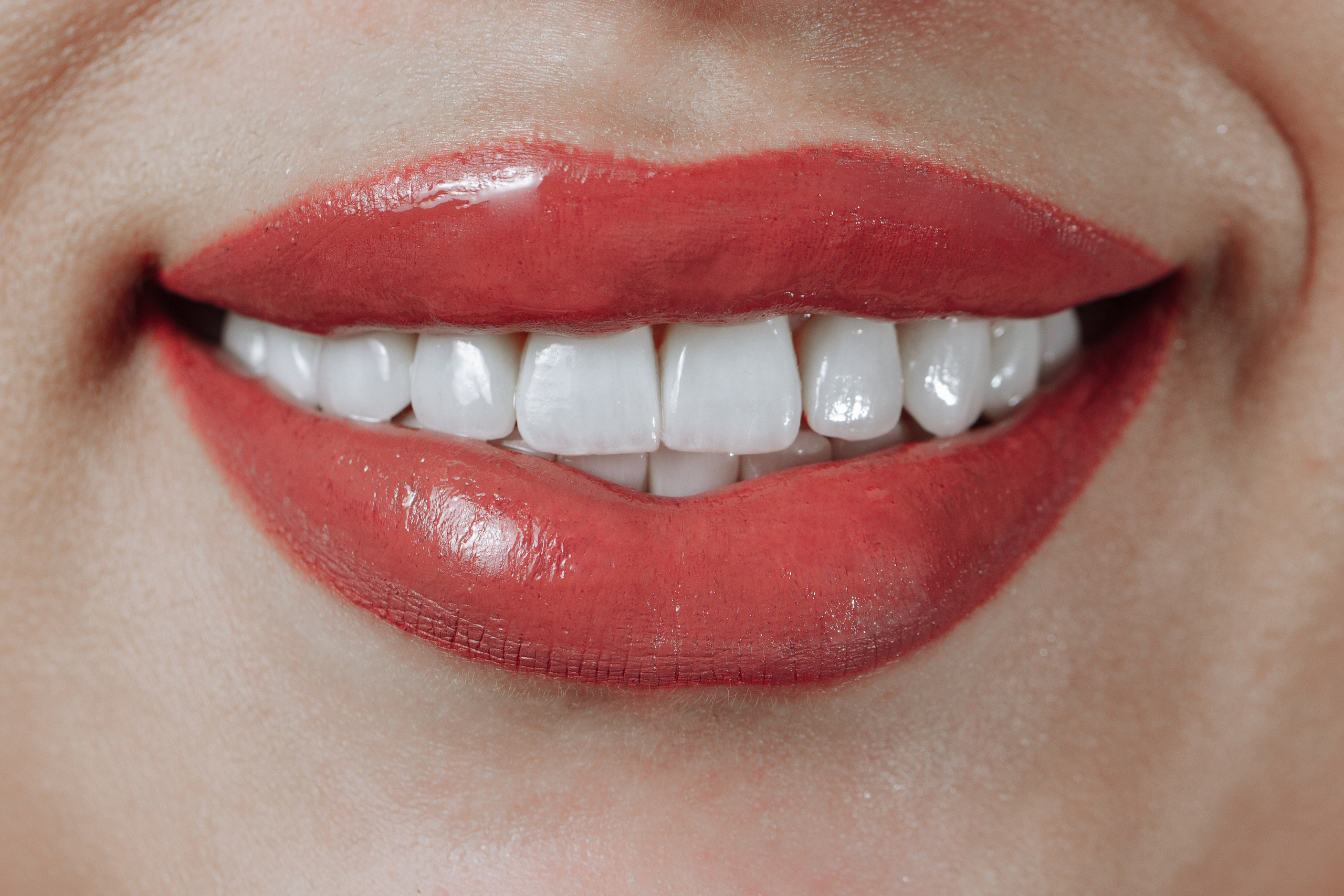 Профессиональная фото и видео съемка стоматологии. Виниры