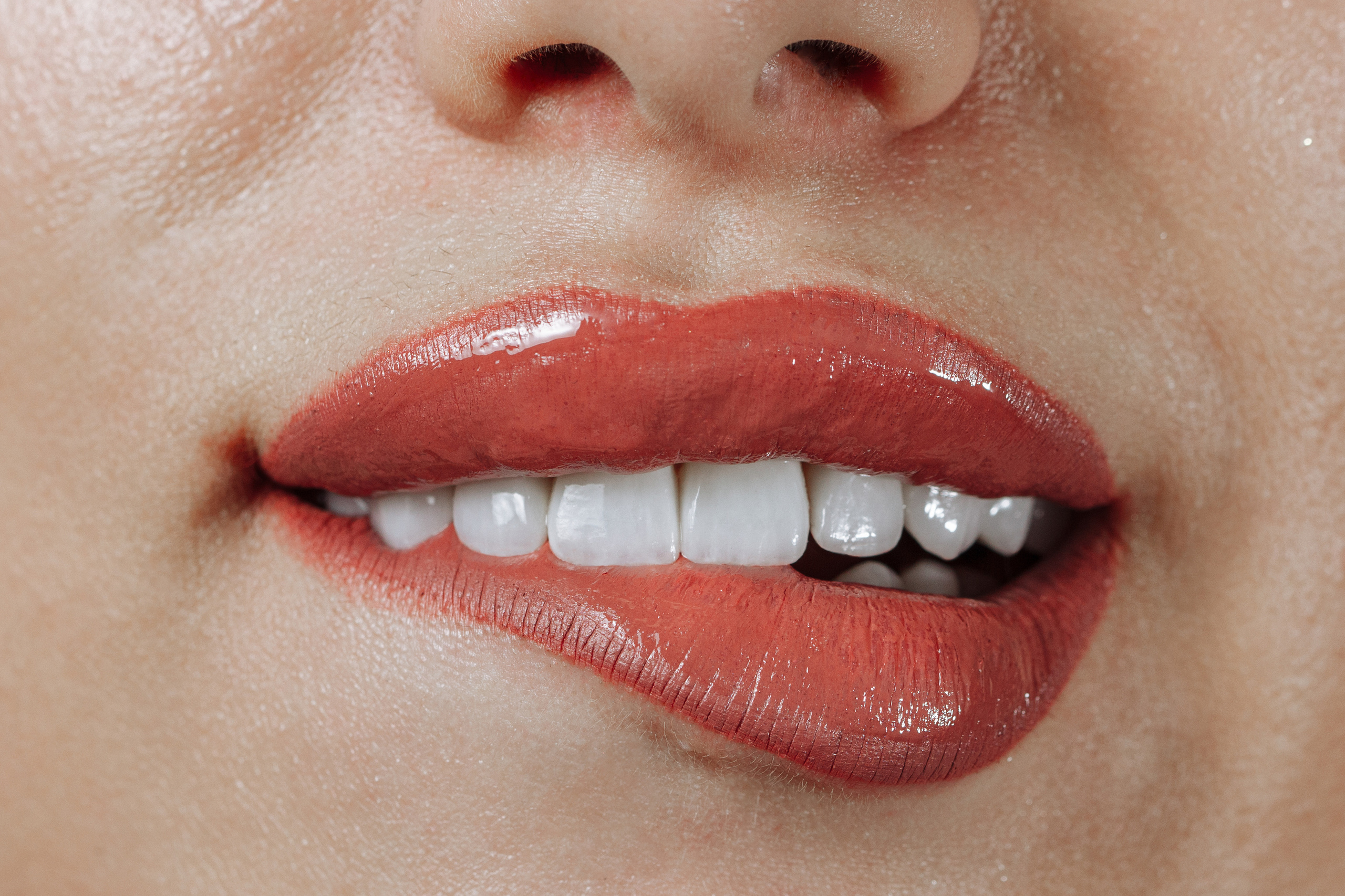 Профессиональная фото и видео съемка стоматологии. Виниры