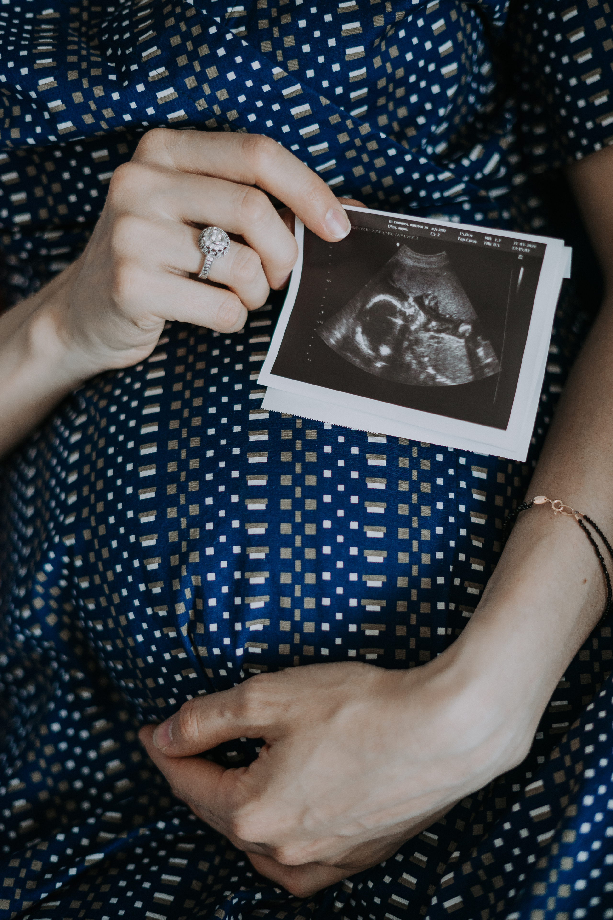 Анна. Свадебный и семейный фотограф в Москве, Юлия Лазарева