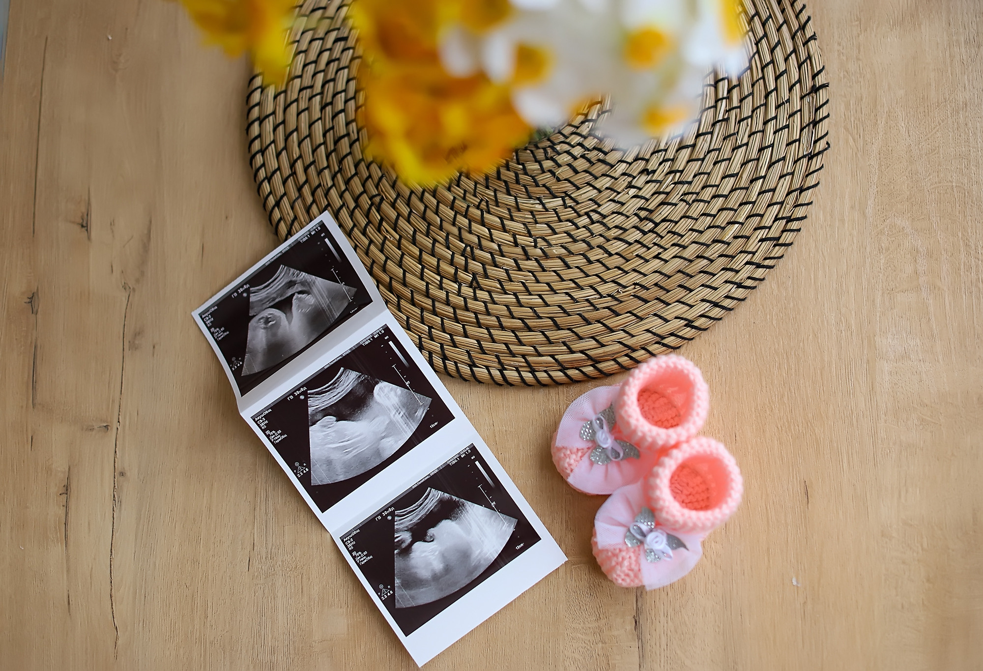 БЕРЕМЕННОСТЬ