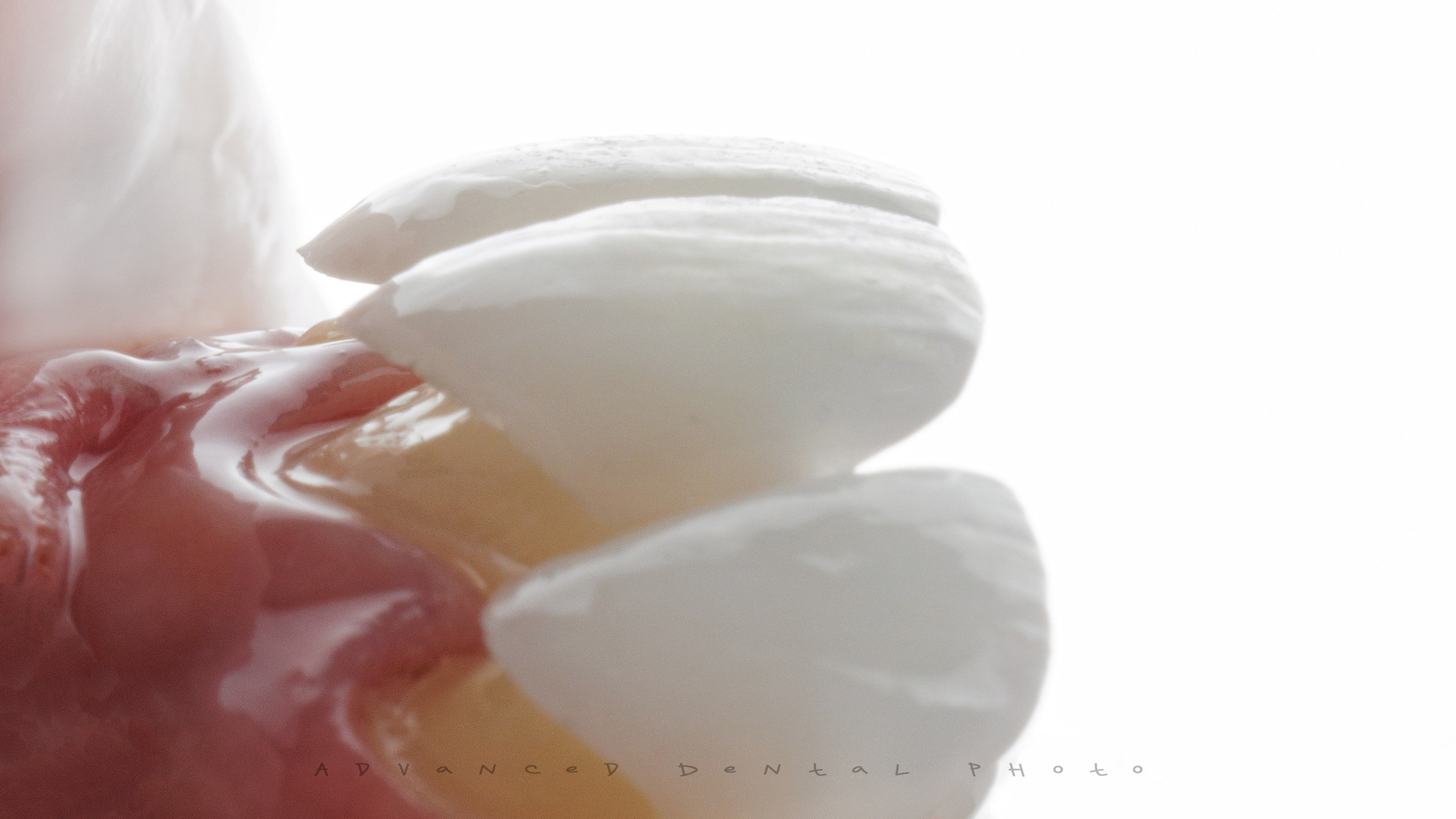 Ортопедия. Дентал фотограф — видеограф Денис Дорошенко