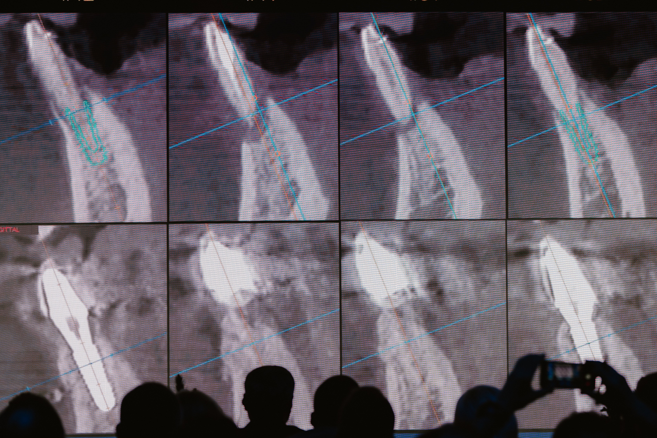 Форум OSSTEM. Фотограф первого впечатления