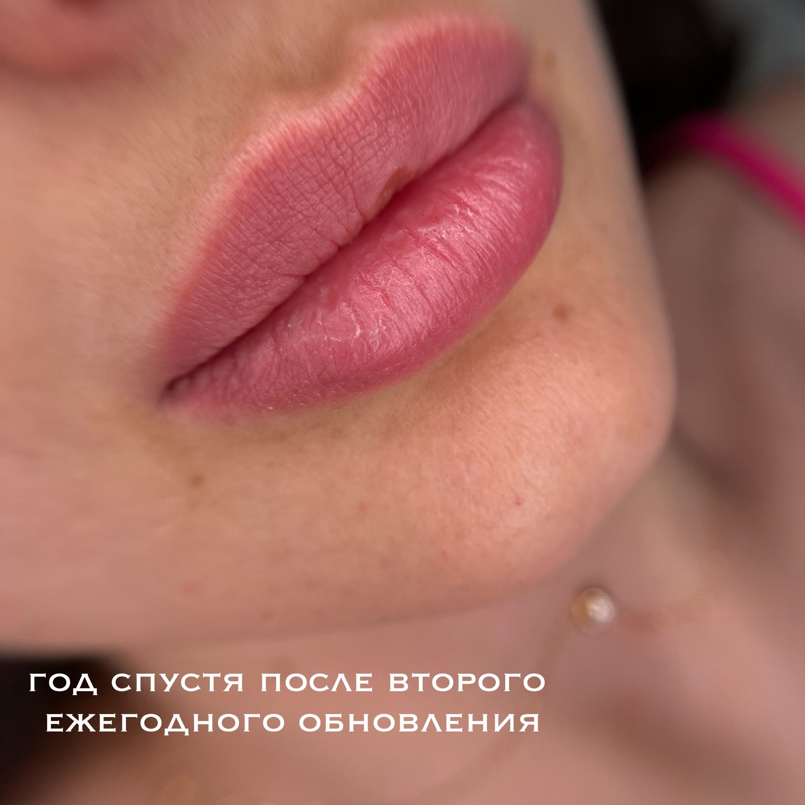 ГУБЫ зажившие. Перманентный макияж и удаление старого татуажа в Ростове-на-Дону Дарья Исакова