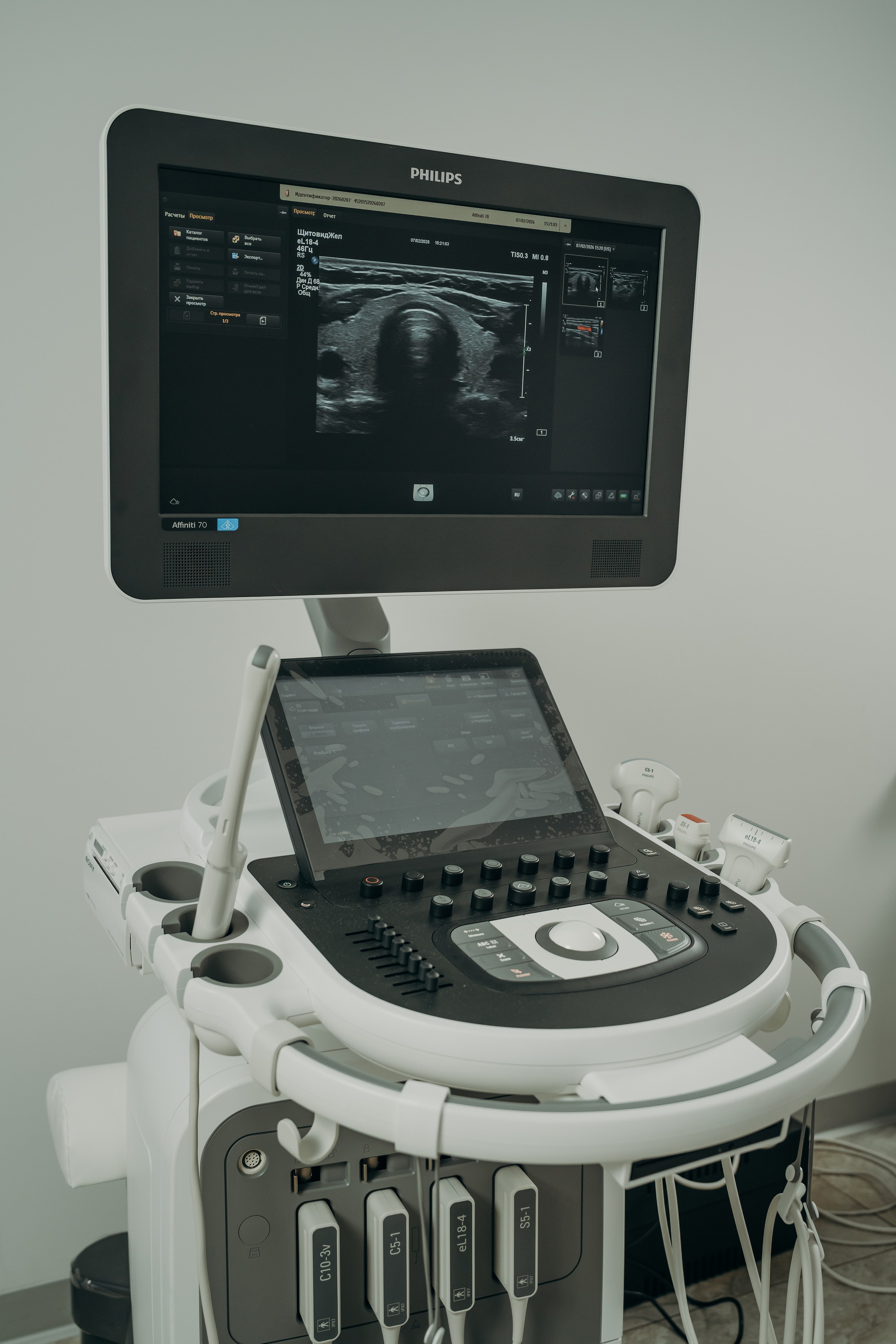 Эхо. Контентный и свадебный фотограф в Краснодаре и Сочи Елена Плотникова