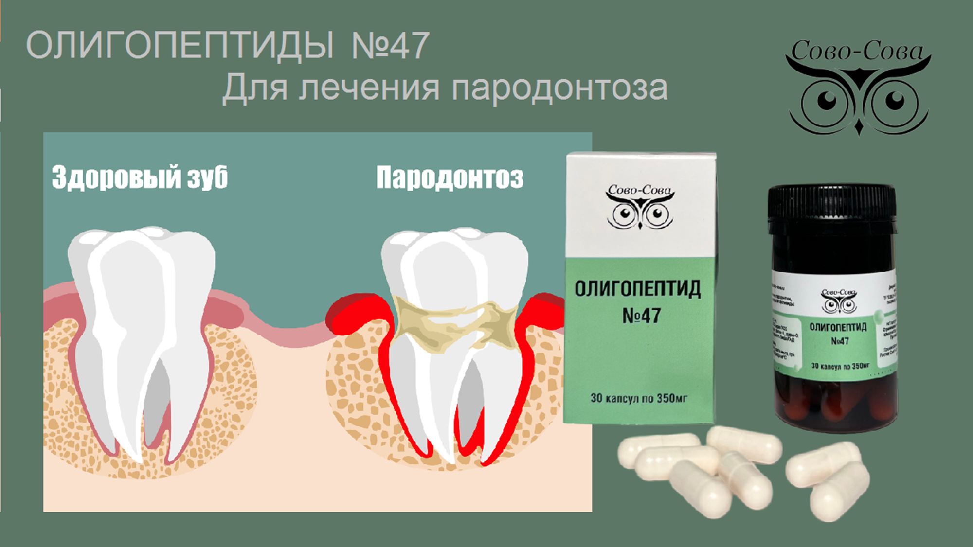 Олигопептид № 47 — Для лечения пародонтита, пародонтоза