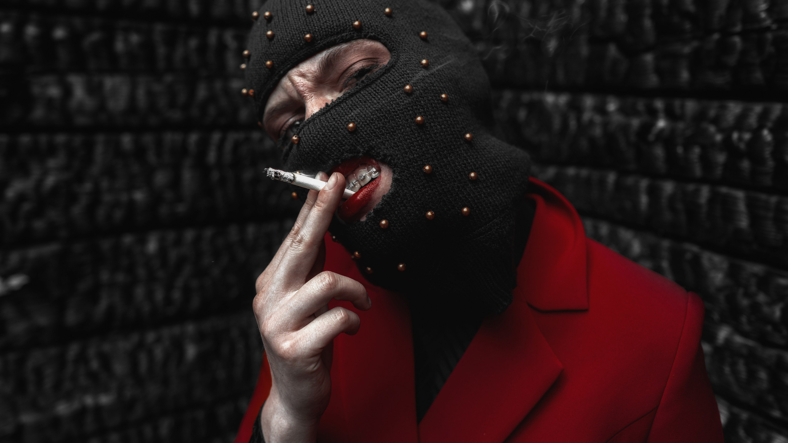 BRACES. Sergey,kuzichev