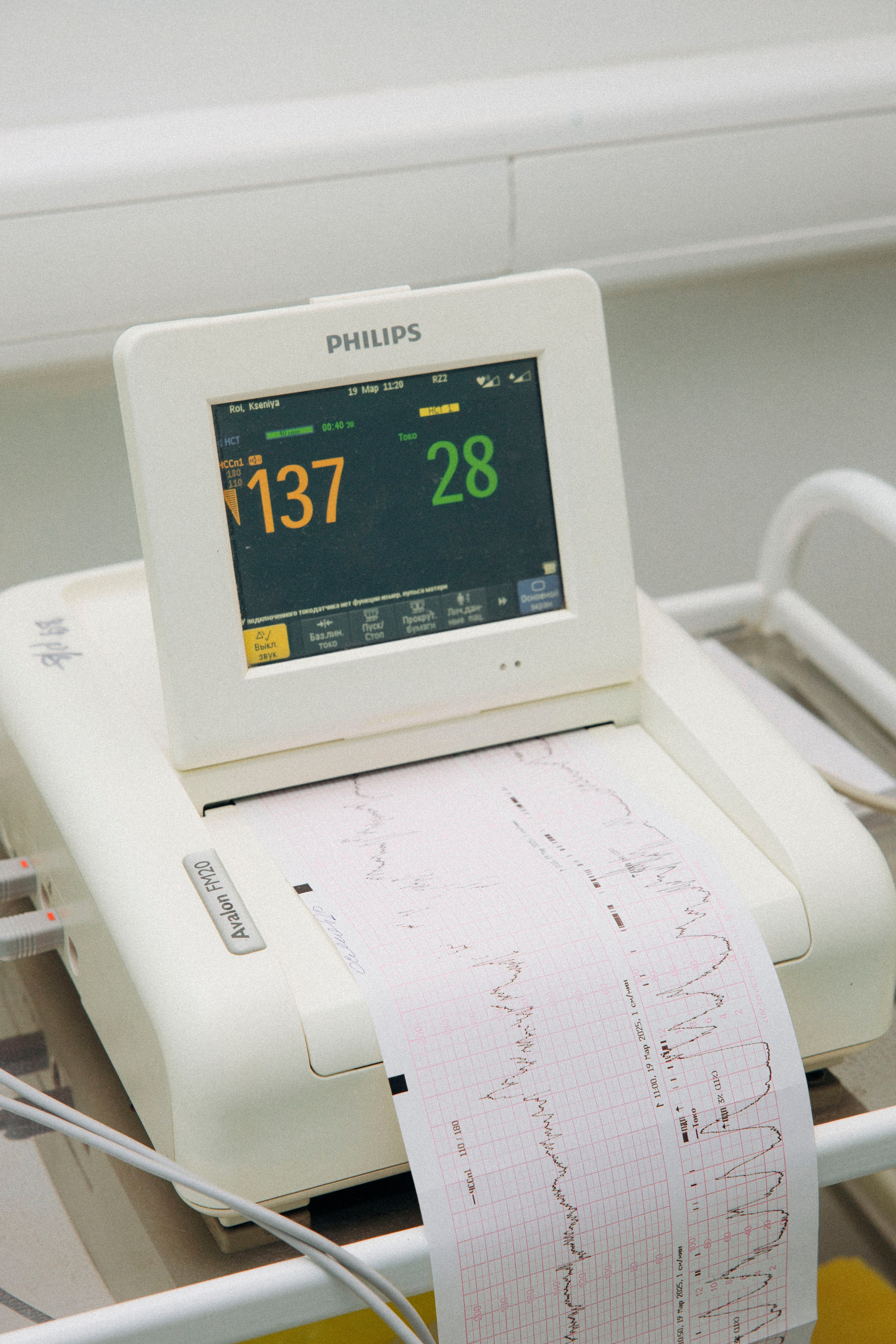 Рождение чуда. Фотослужба «Малютка» в Наро-Фоминском перинатальном центре — сохраняем главные мгновения семьи и создаём премиальные фотокниги