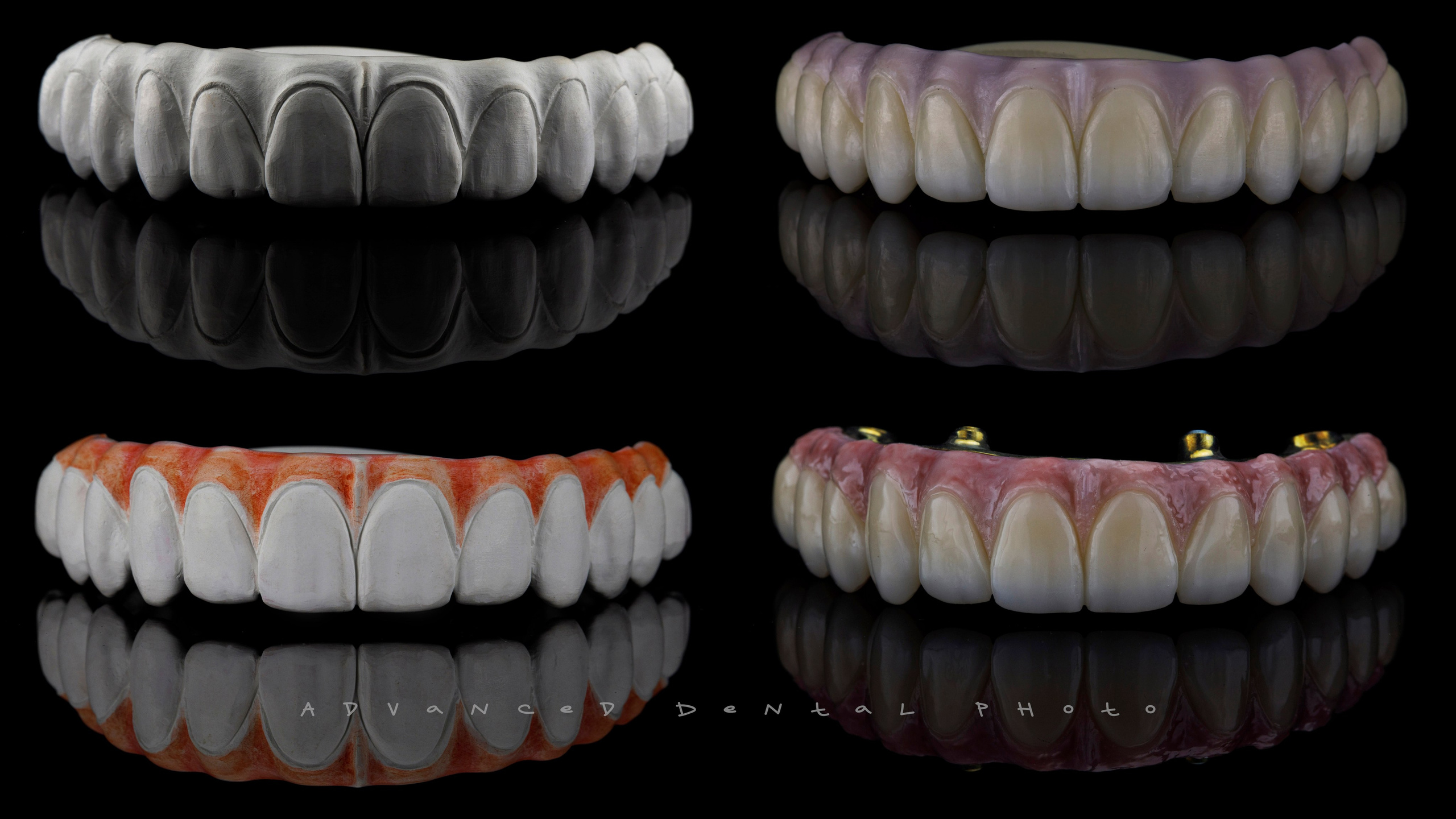 Предметная съёмка. Дентал фотограф — видеограф Денис Дорошенко