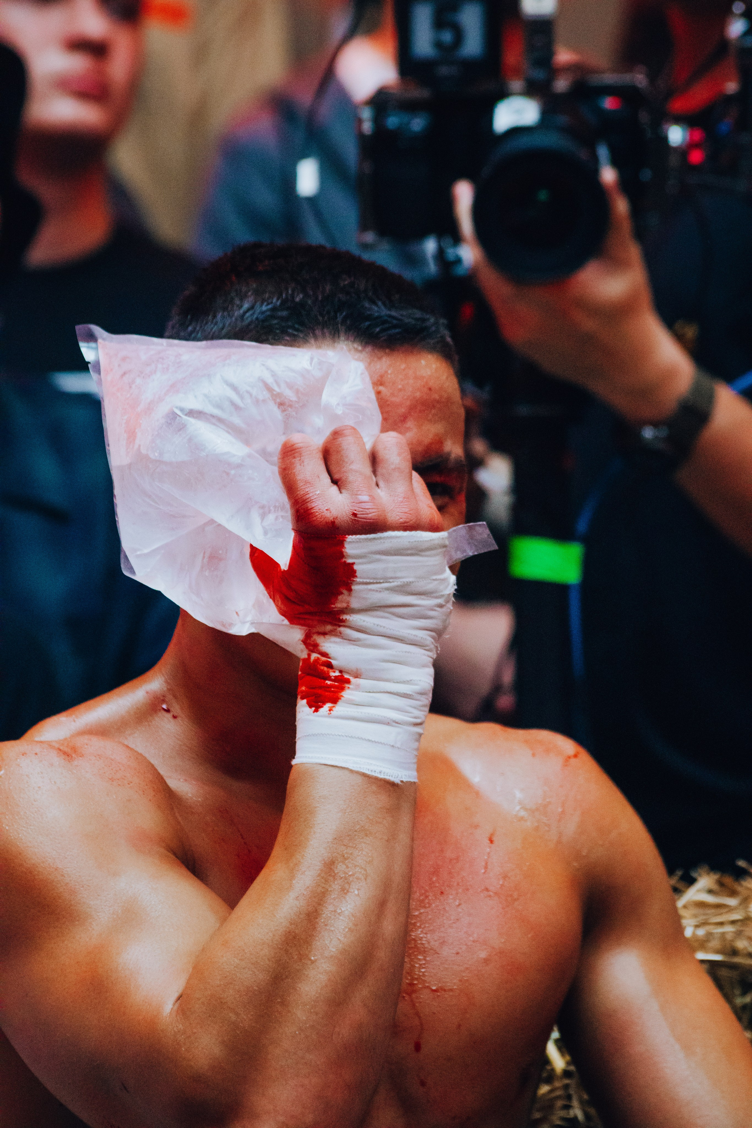 Кулачные бои TopDog. Анастасия Тен