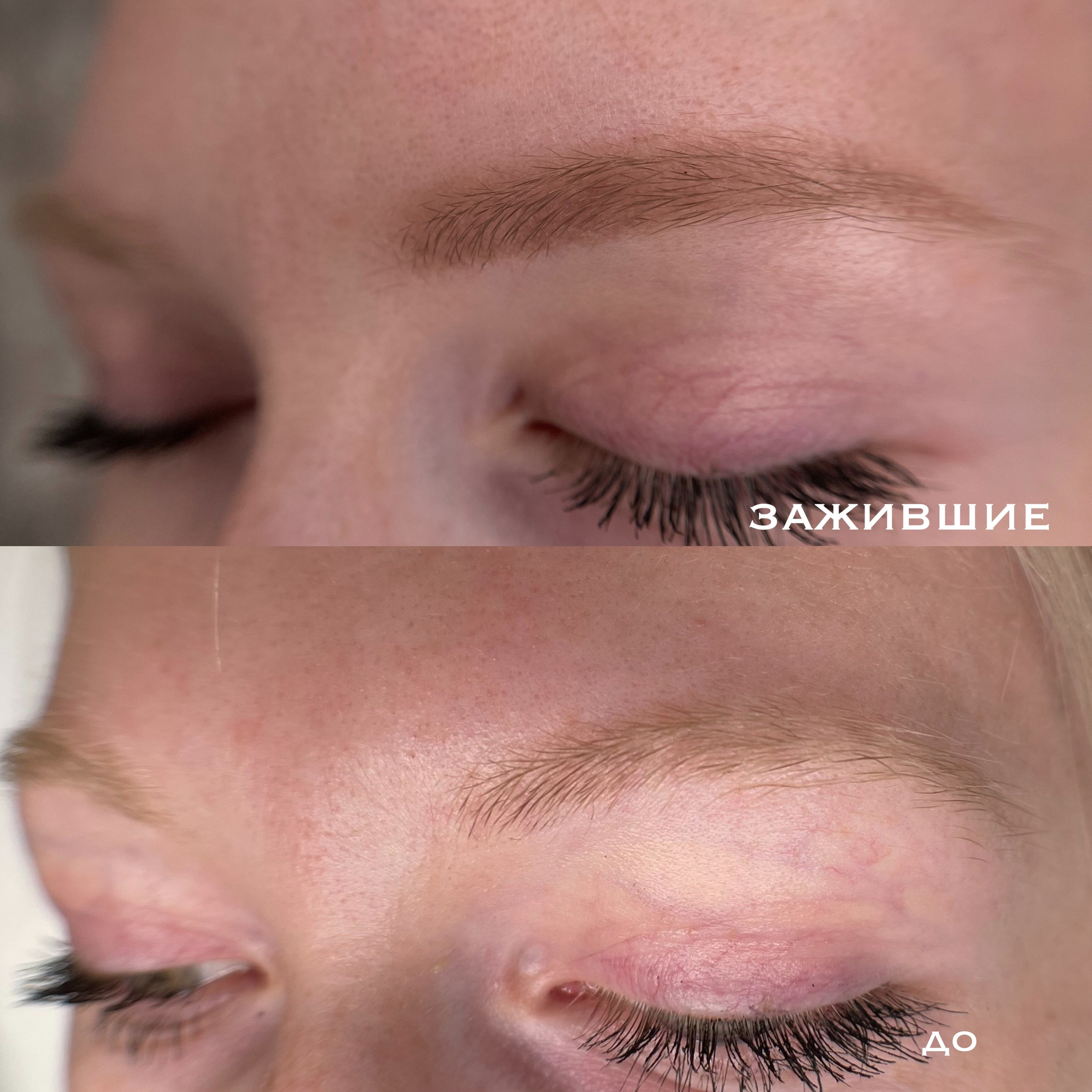 БРОВИ зажившие. Перманентный макияж и удаление старого татуажа в Ростове-на-Дону Дарья Исакова