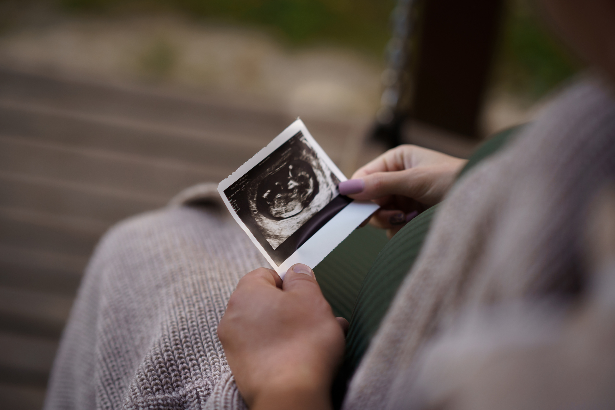 В любимом городском парке Скитские пруды г. Сергиев посад. Семейный и детский фотограф в Сергиев Посаде, Хотьково Якимчук Любовь