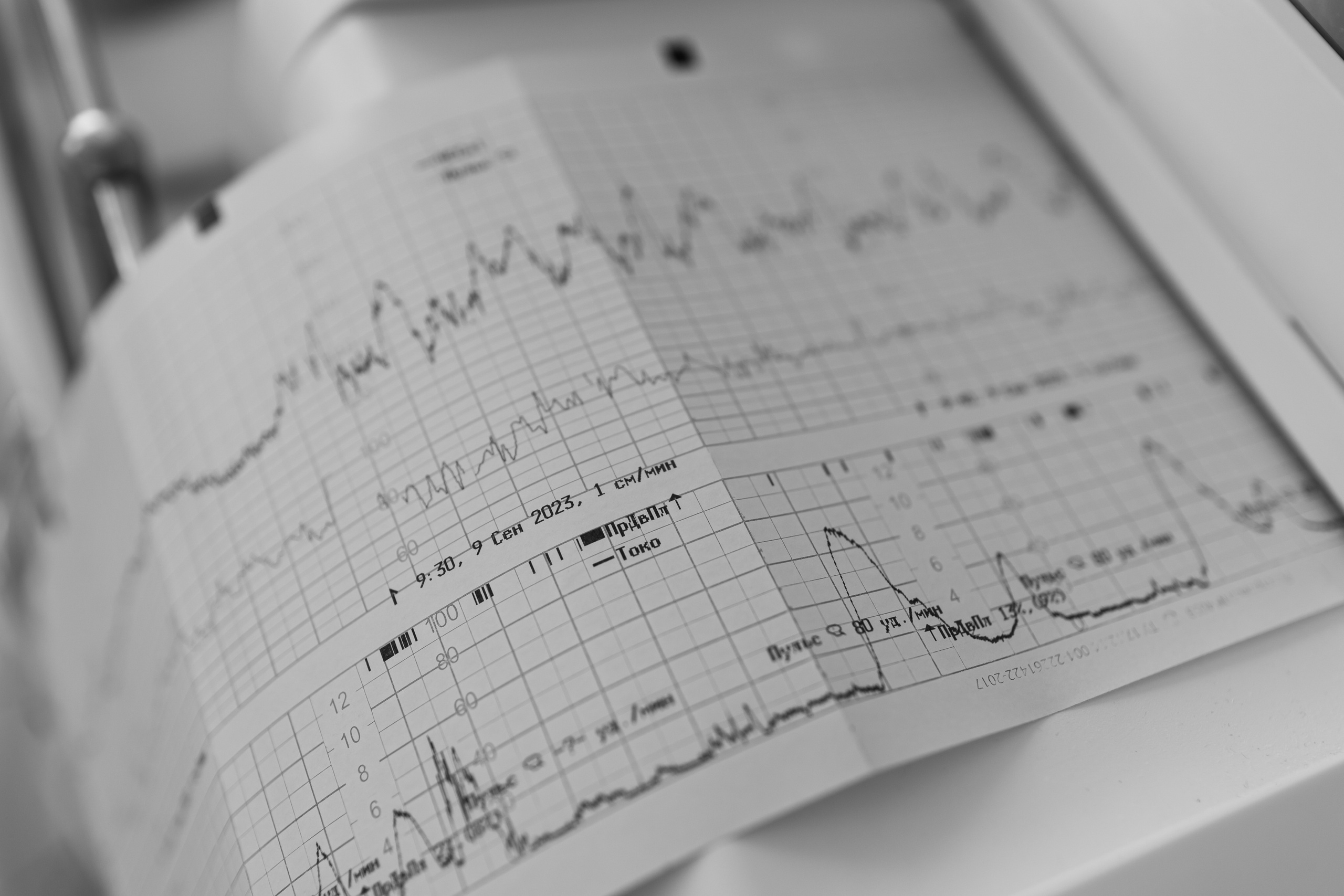 Съемка родов. Рождение Матвея. ГПЦ № 1. Фотограф на роды в Санкт-Петербурге Екатерина Сысоева