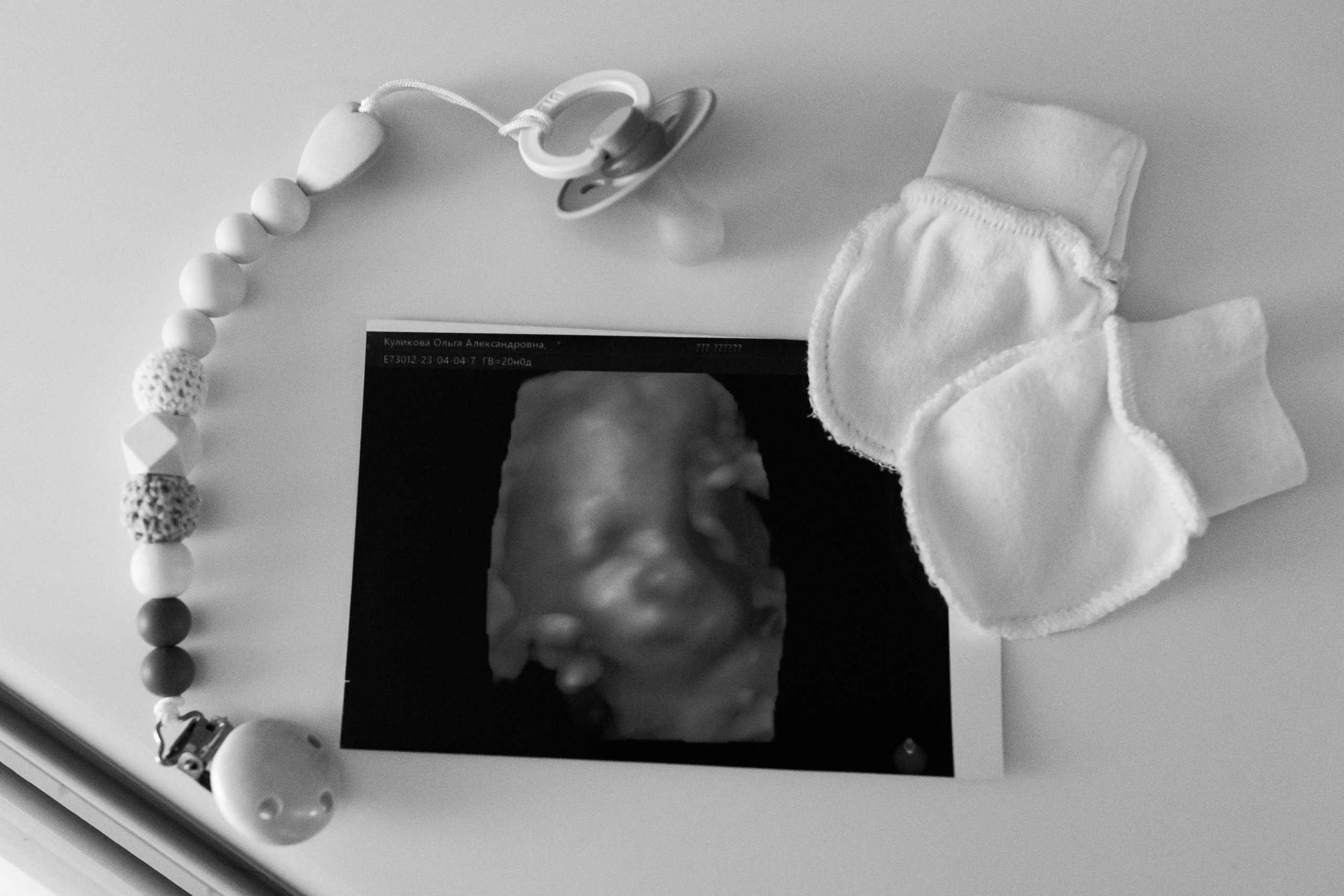 Съемка родов. Рождение Виктории. Клинический госпиталь MD GROUP Лахта. Фотограф на роды в Санкт-Петербурге Екатерина Сысоева