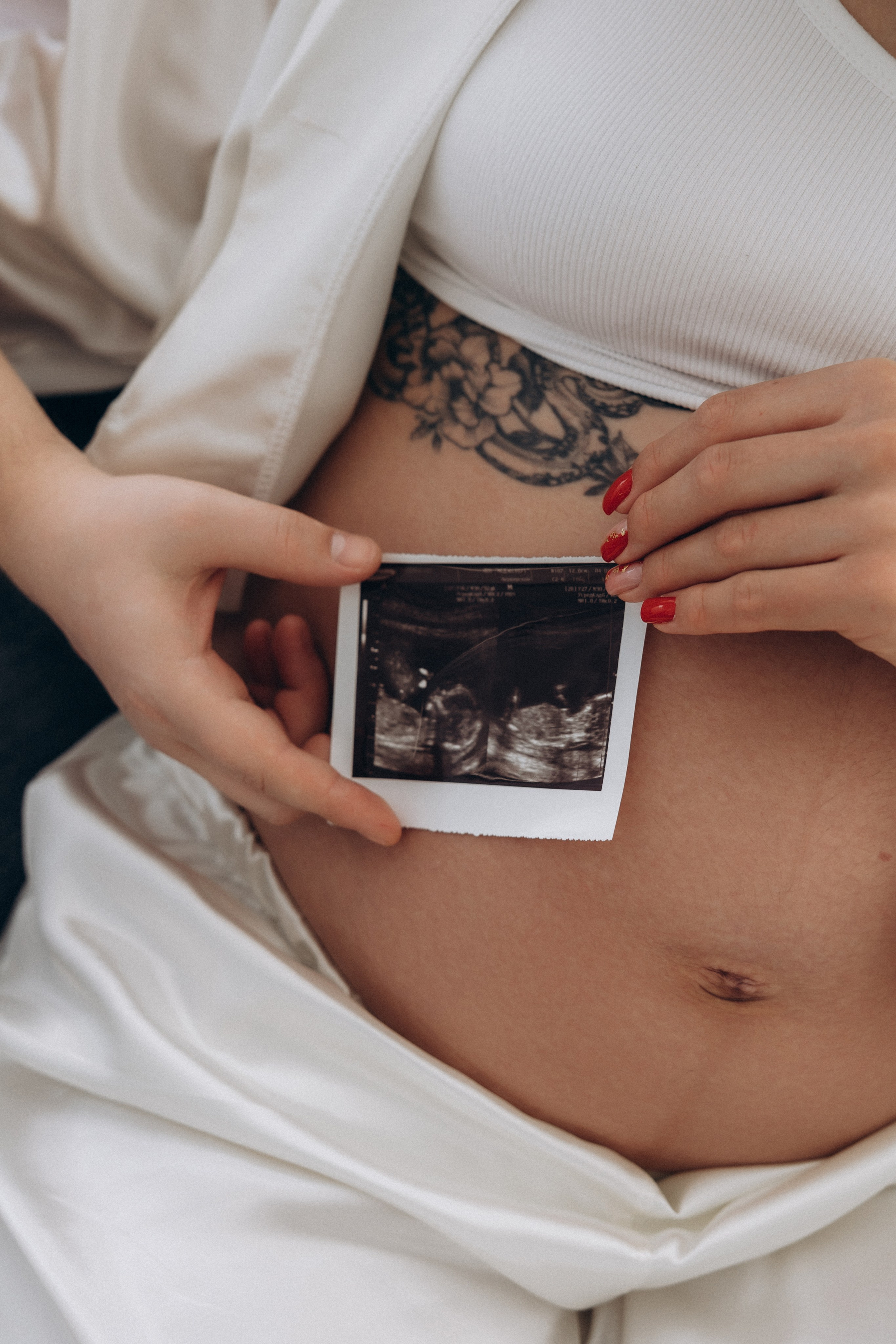 Беременность. Марьяна Белая