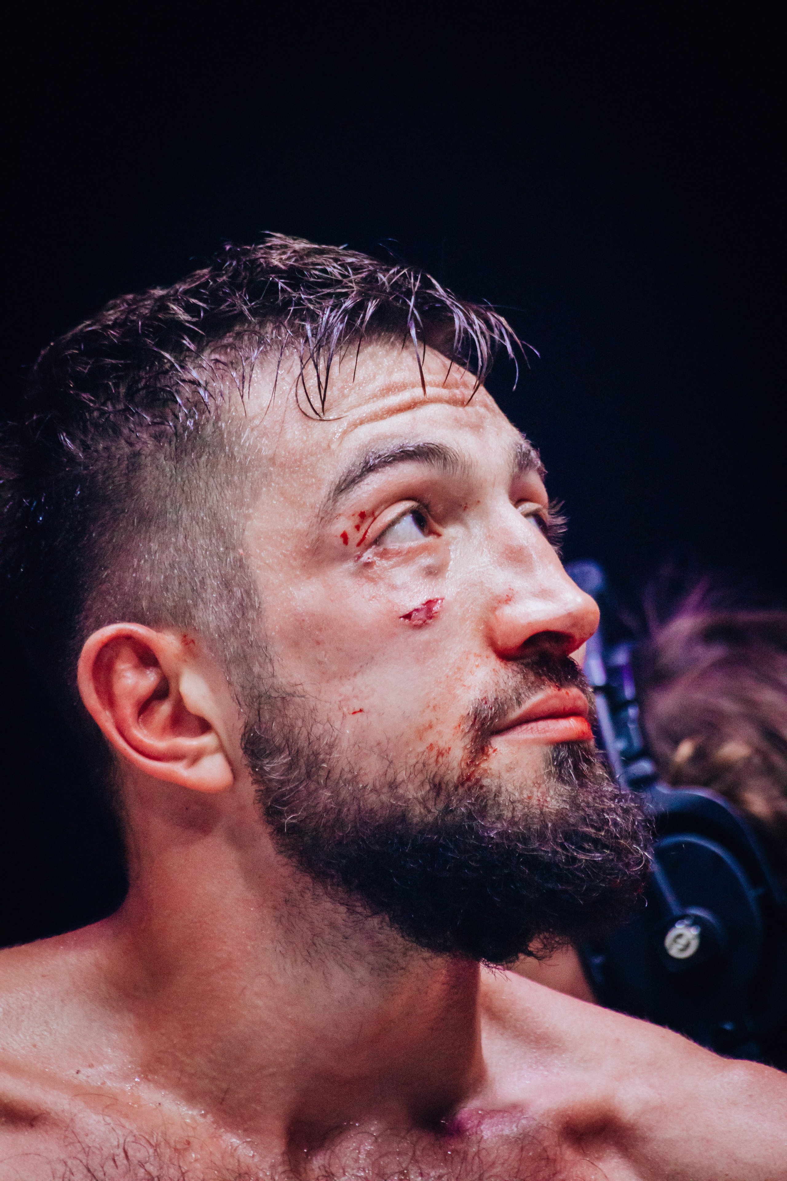 Кулачные бои TopDog. Анастасия Тен