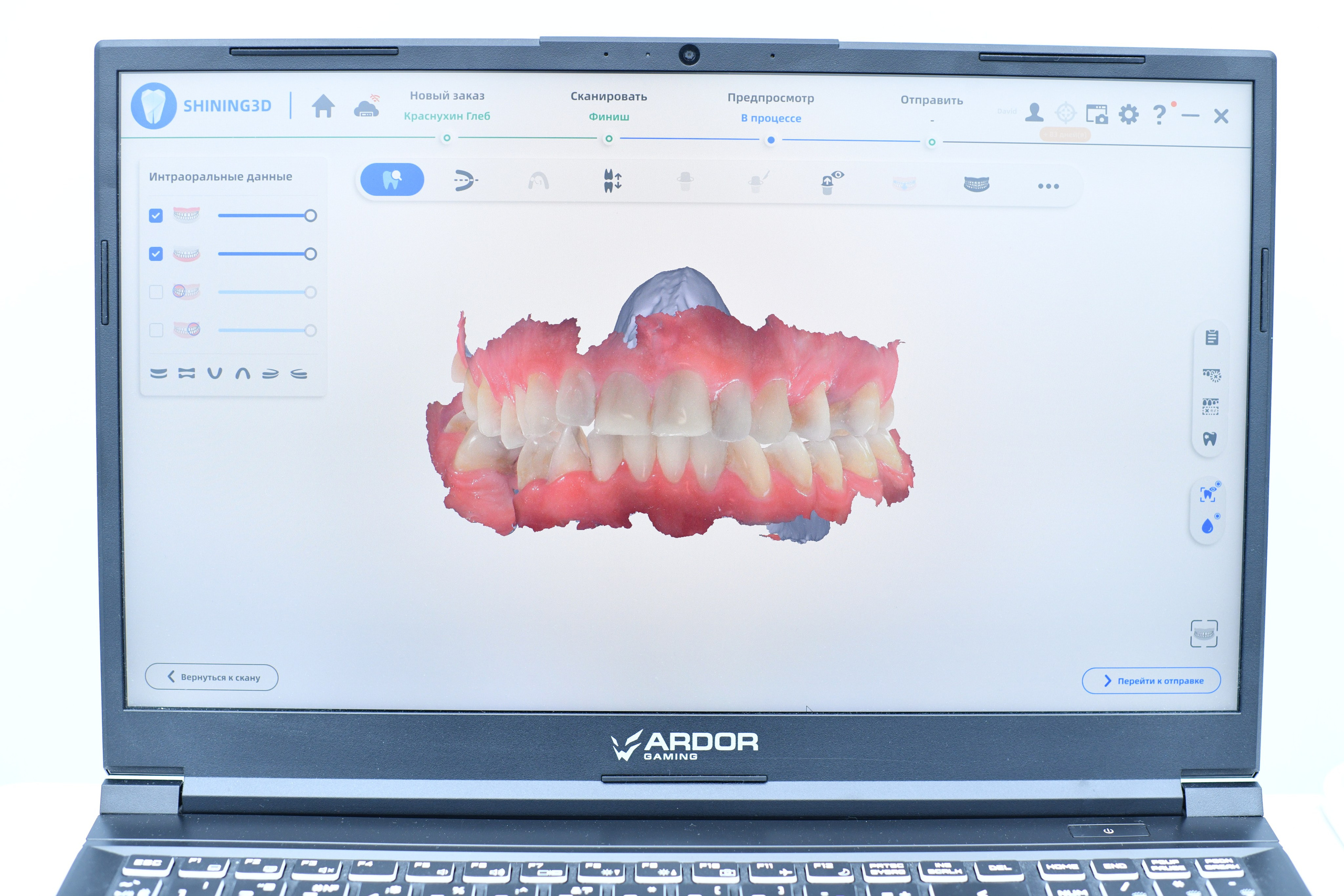 Зубная клиника. Свадебный и портретный фотограф в Москве Галина Борисова
