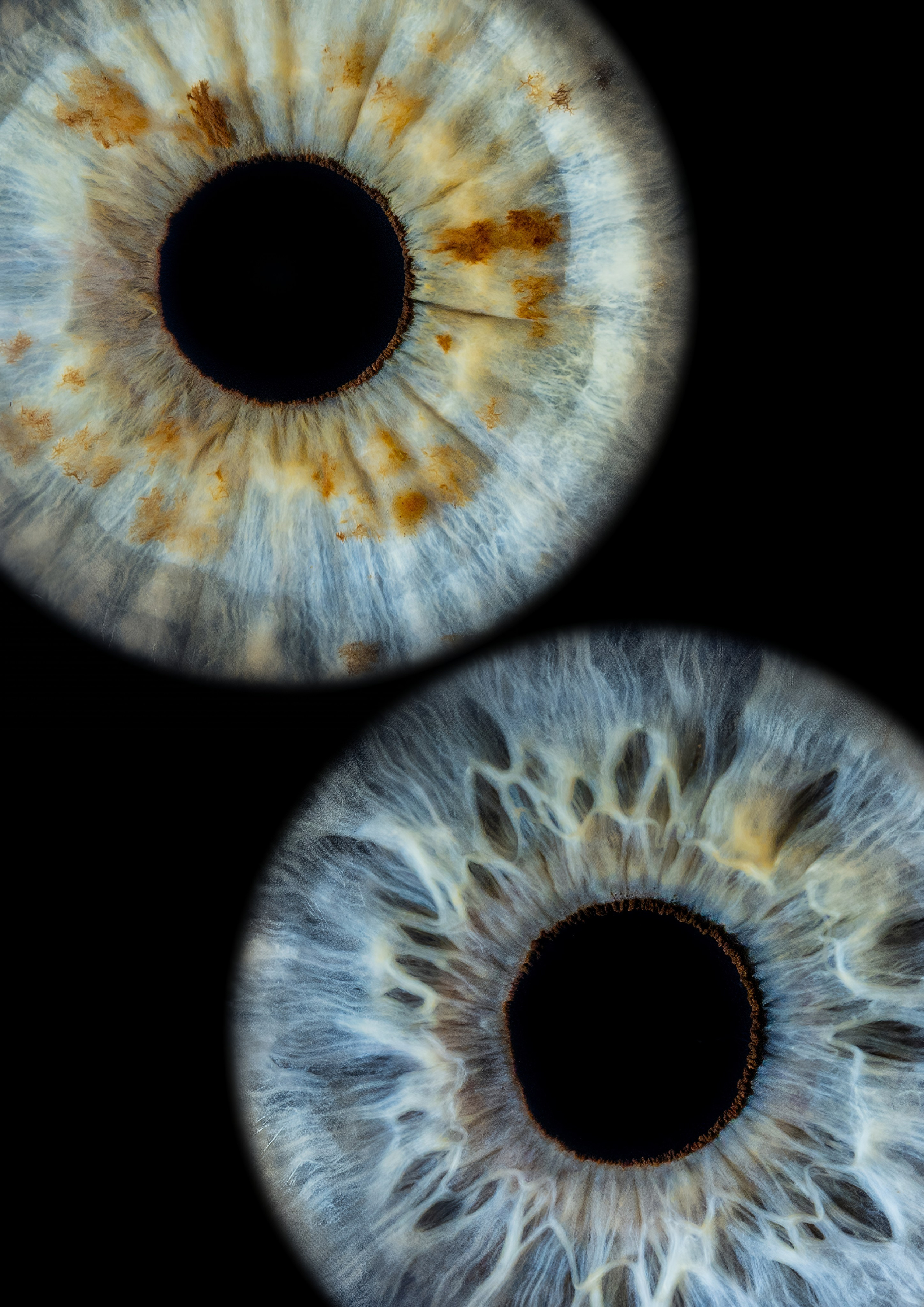 Примеры работ. Мой глаз