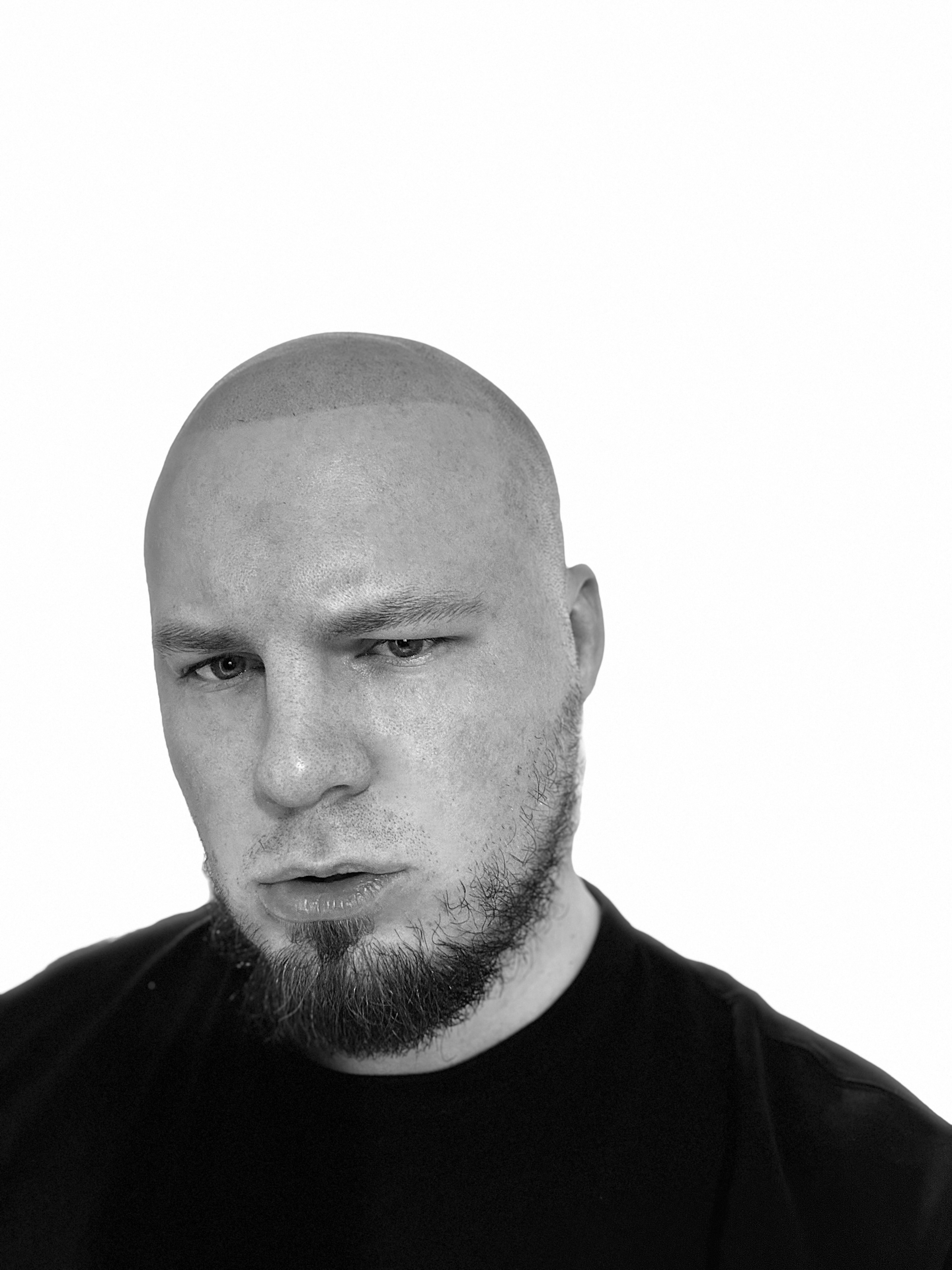 Нажмите на фото что бы открыть. SMP Трихопигментация Воронеж Волгоград Москва Казань Никита Нестеров