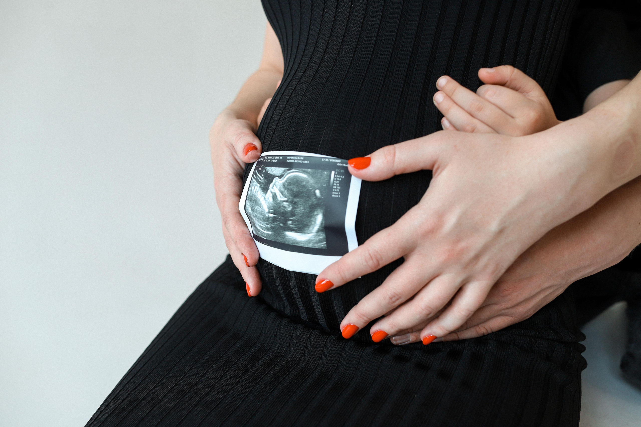 Дейли Циклорама Катя и Дима. Фотограф и Видеограф в Санкт-Петербурге Алиса Шандрик