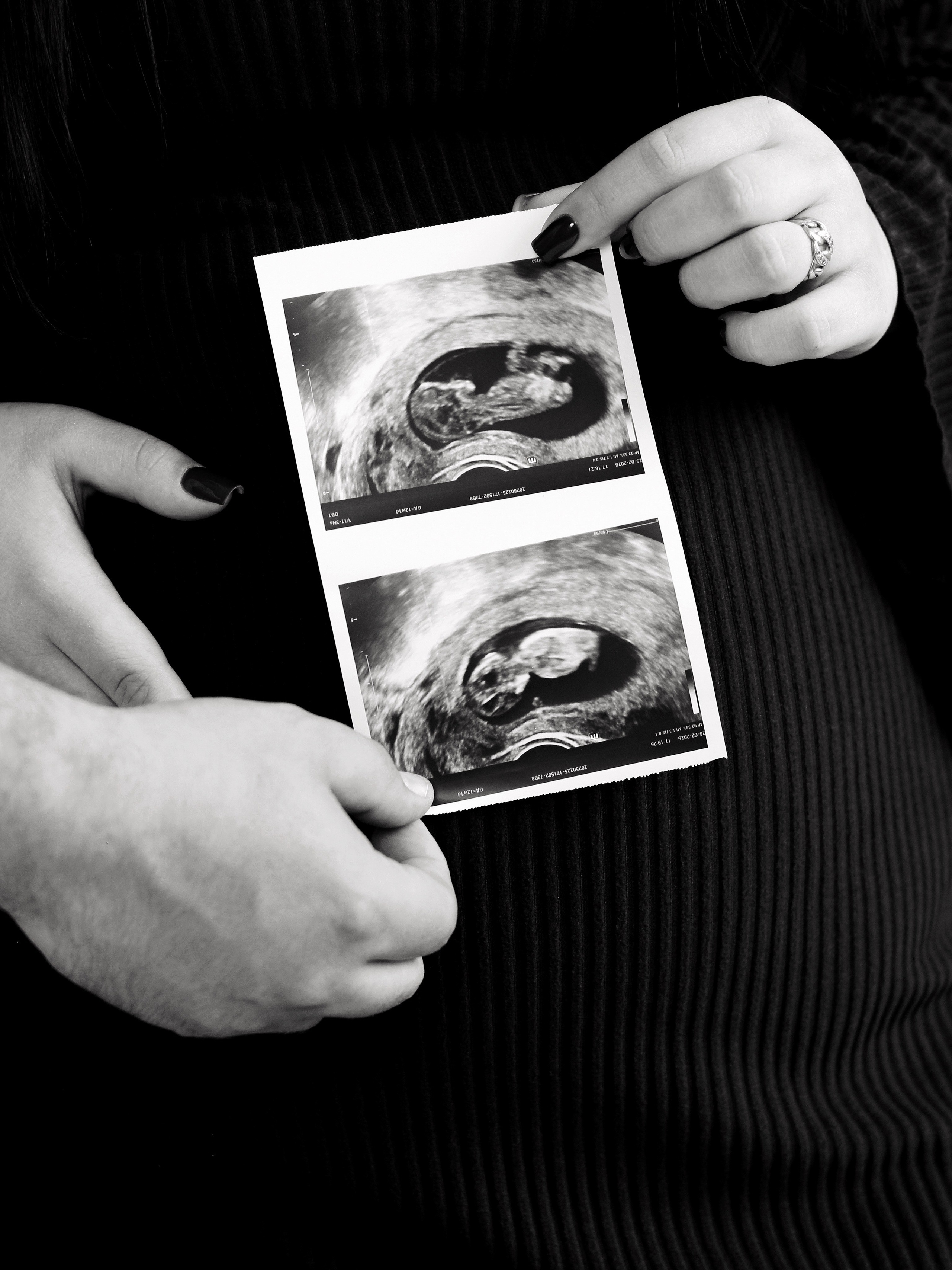 Гендер пати. Photography Eva