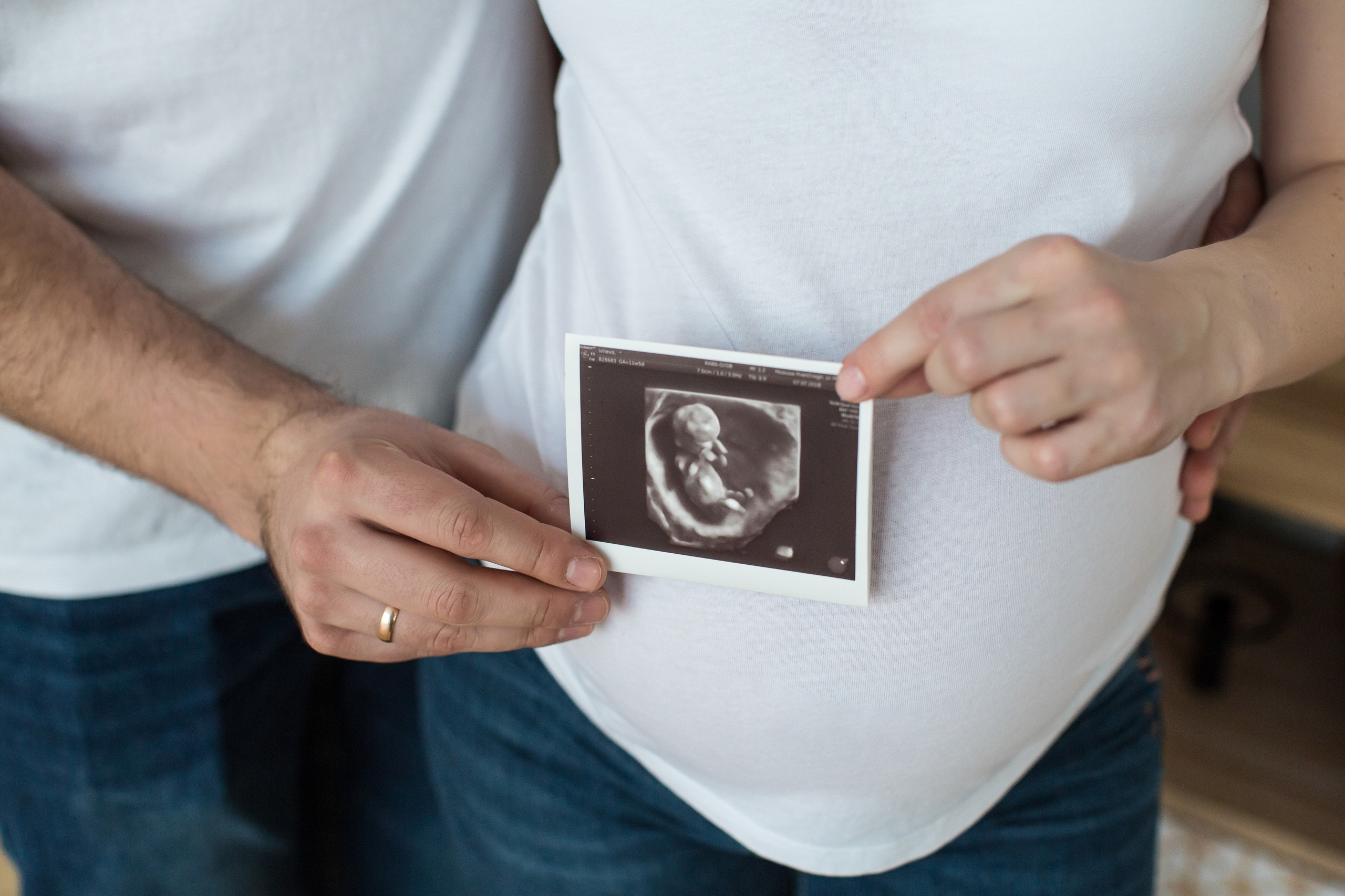 Беременность. Свадебный фотограф в Москве и МО Анна Чукова