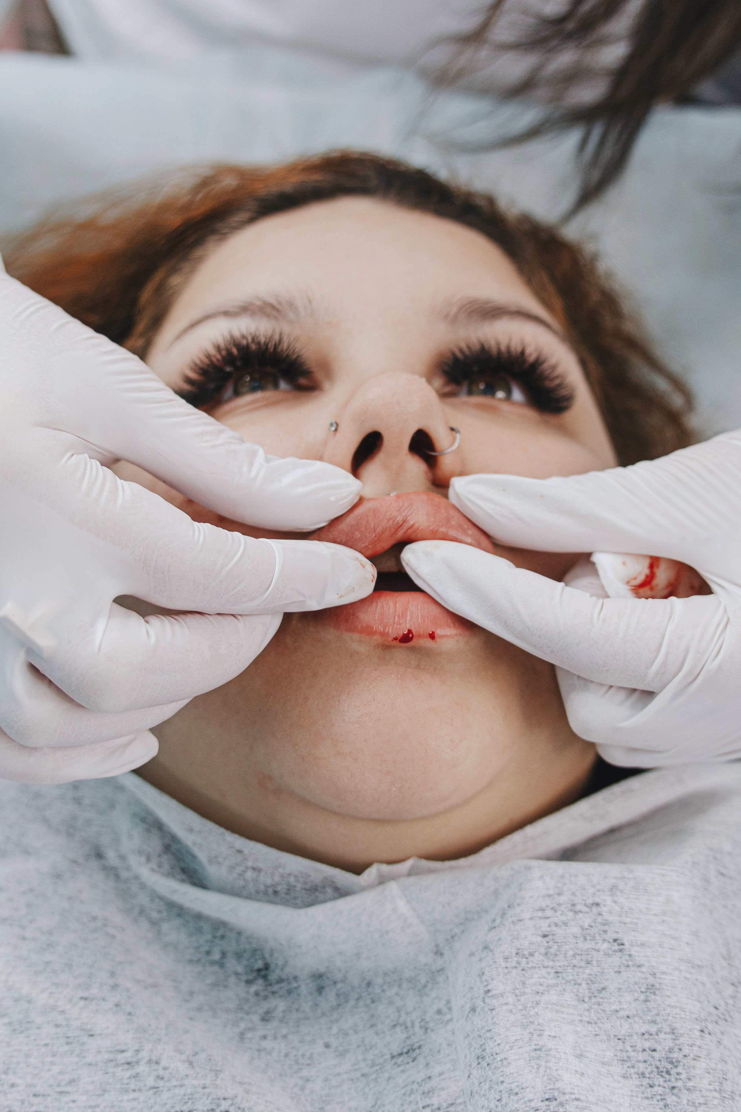 Крупный план рук косметолога, увеличение губ