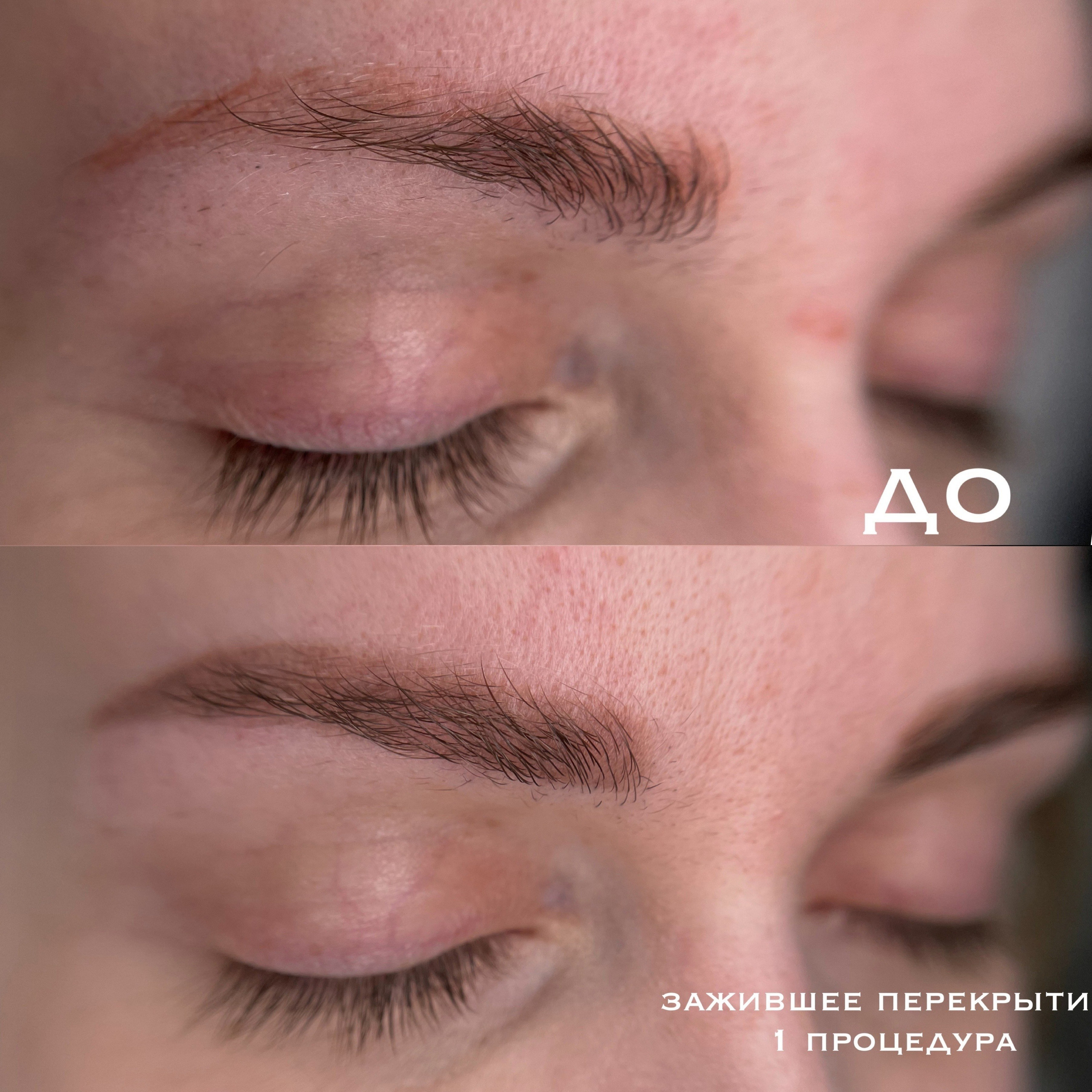 БРОВИ зажившие. Перманентный макияж и удаление старого татуажа в Ростове-на-Дону Дарья Исакова