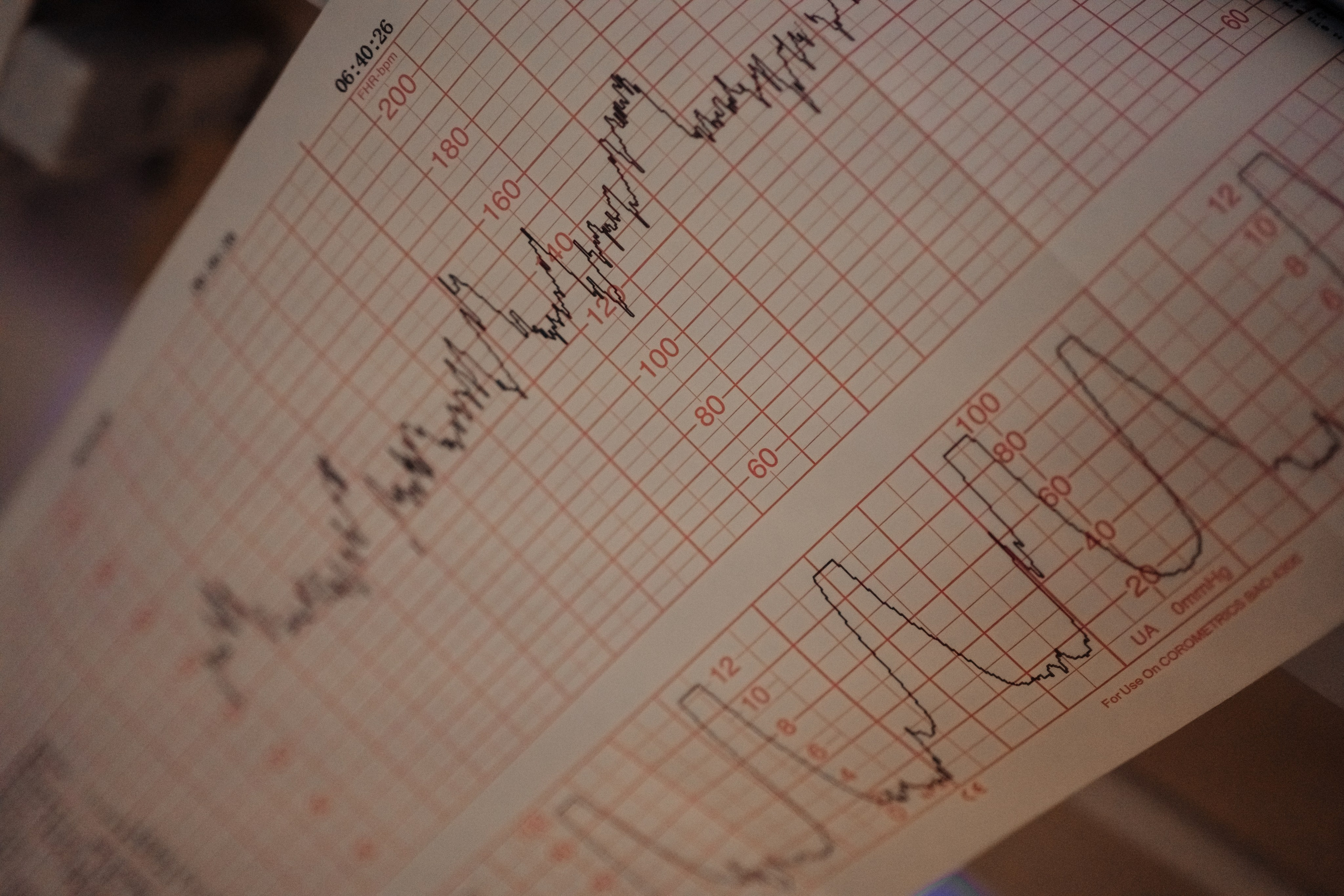 Съемка родов цвет. Фотограф и видеограф на роды в Москве Подшивалова Полина