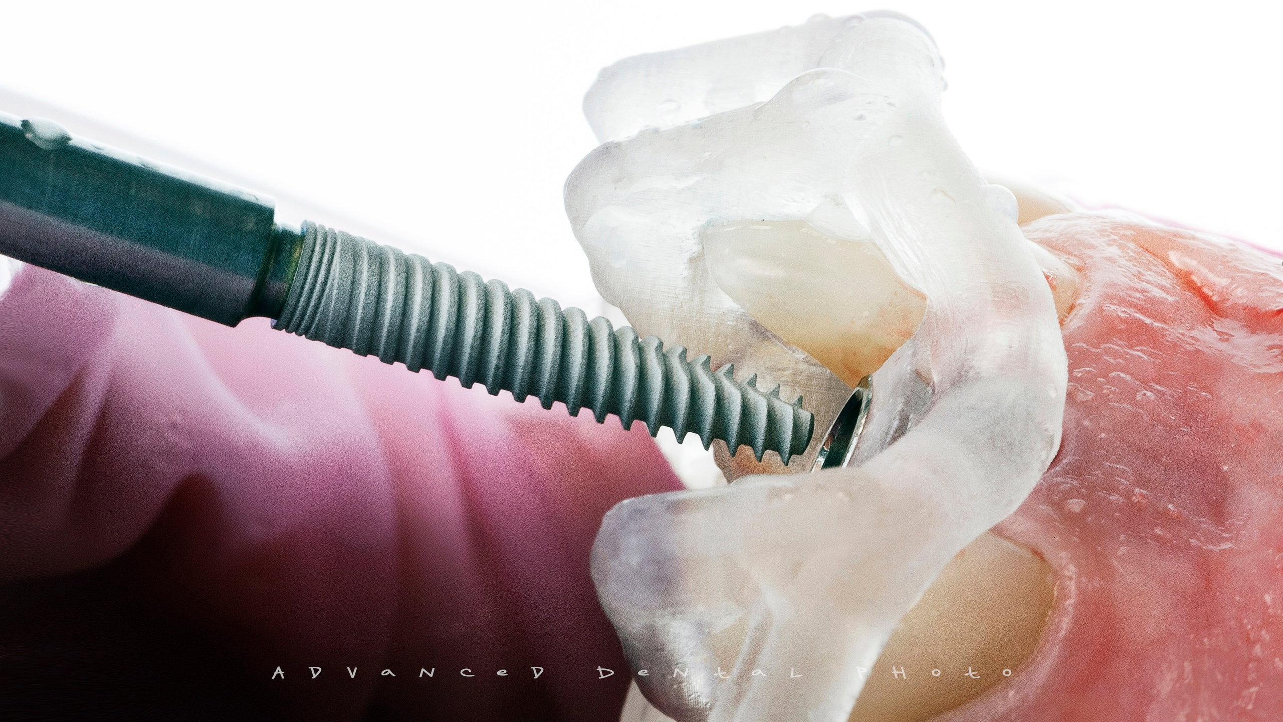 Хирургия. Дентал фотограф — видеограф Денис Дорошенко
