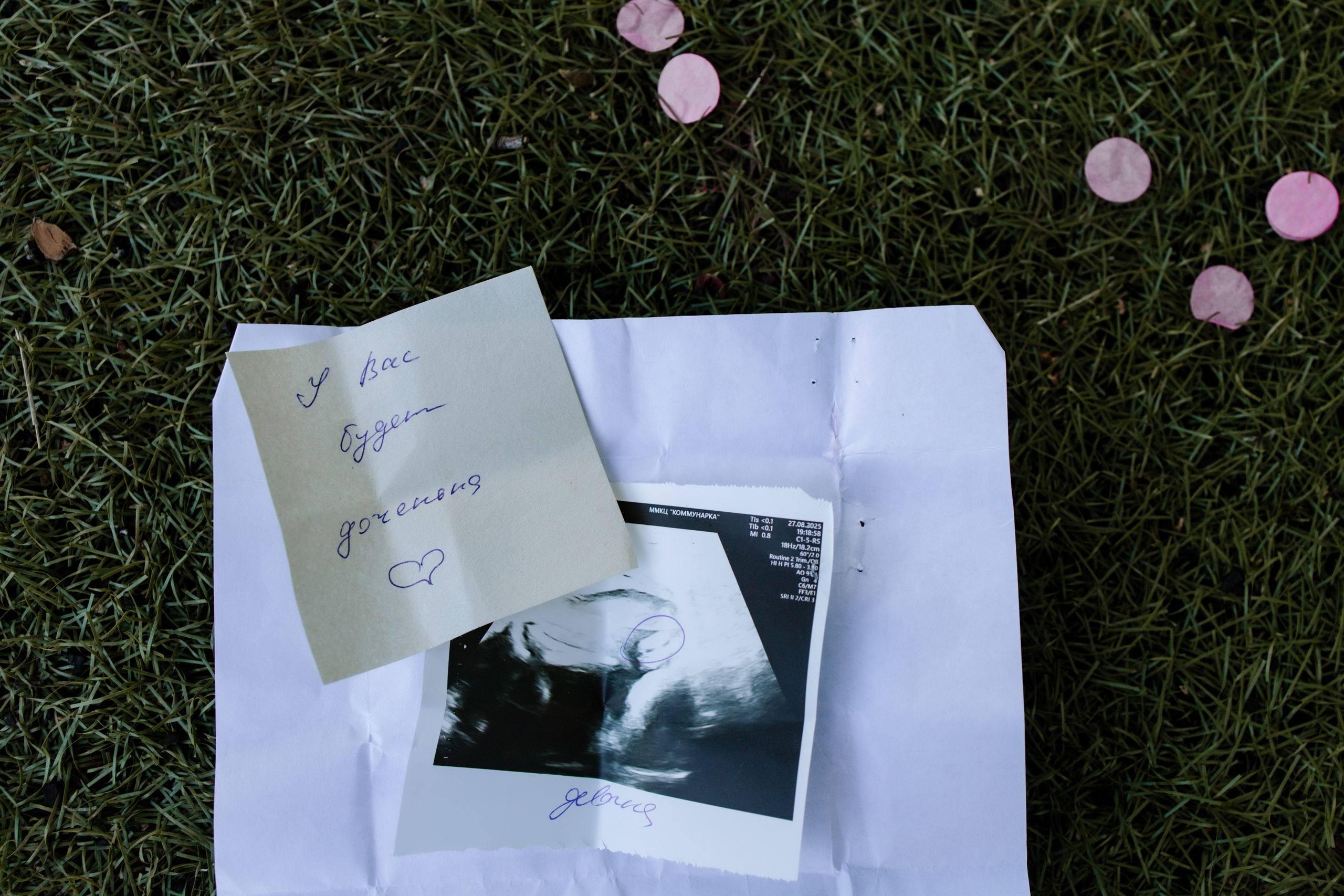 Гендерпати. Фотограф новорождённых в Москве и МО