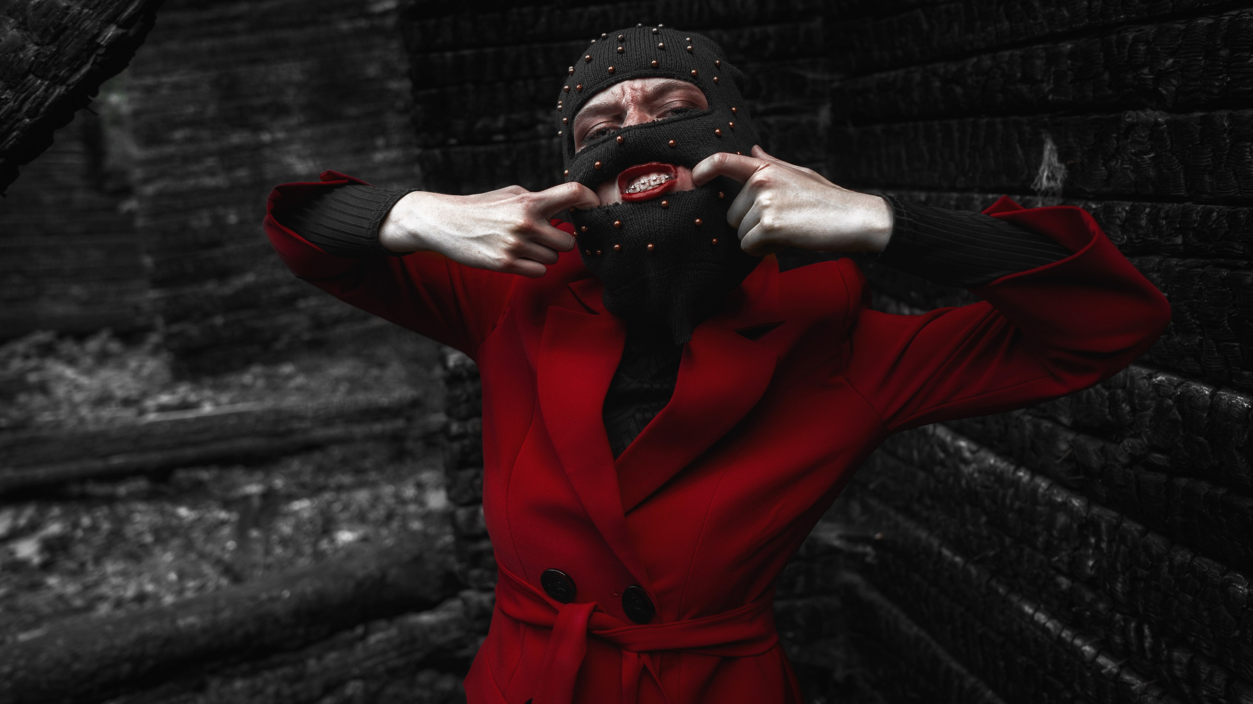 BRACES. Sergey,kuzichev