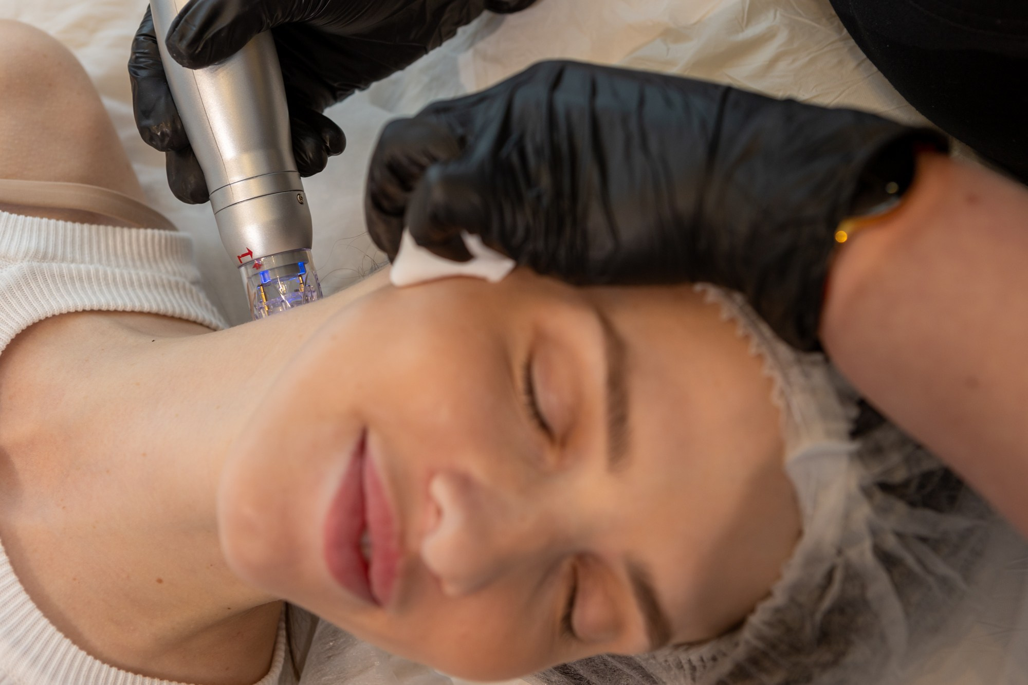 Микроигольчатый RF-лифтинг Scarlet S. Фотограф в Оренбурге. Профессиональный фотограф