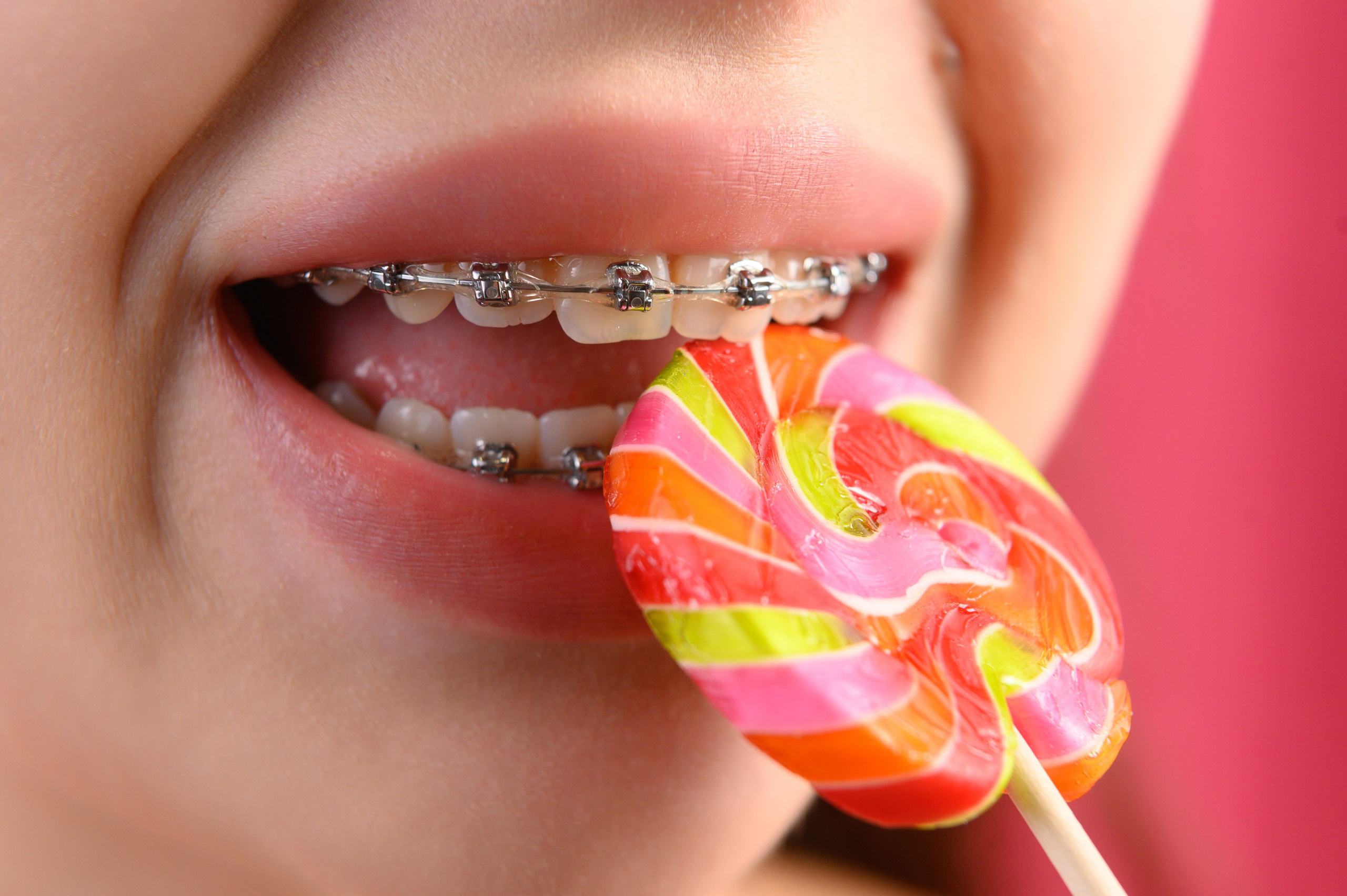 Профессиональная фото и видео съемка стоматологии. Виниры