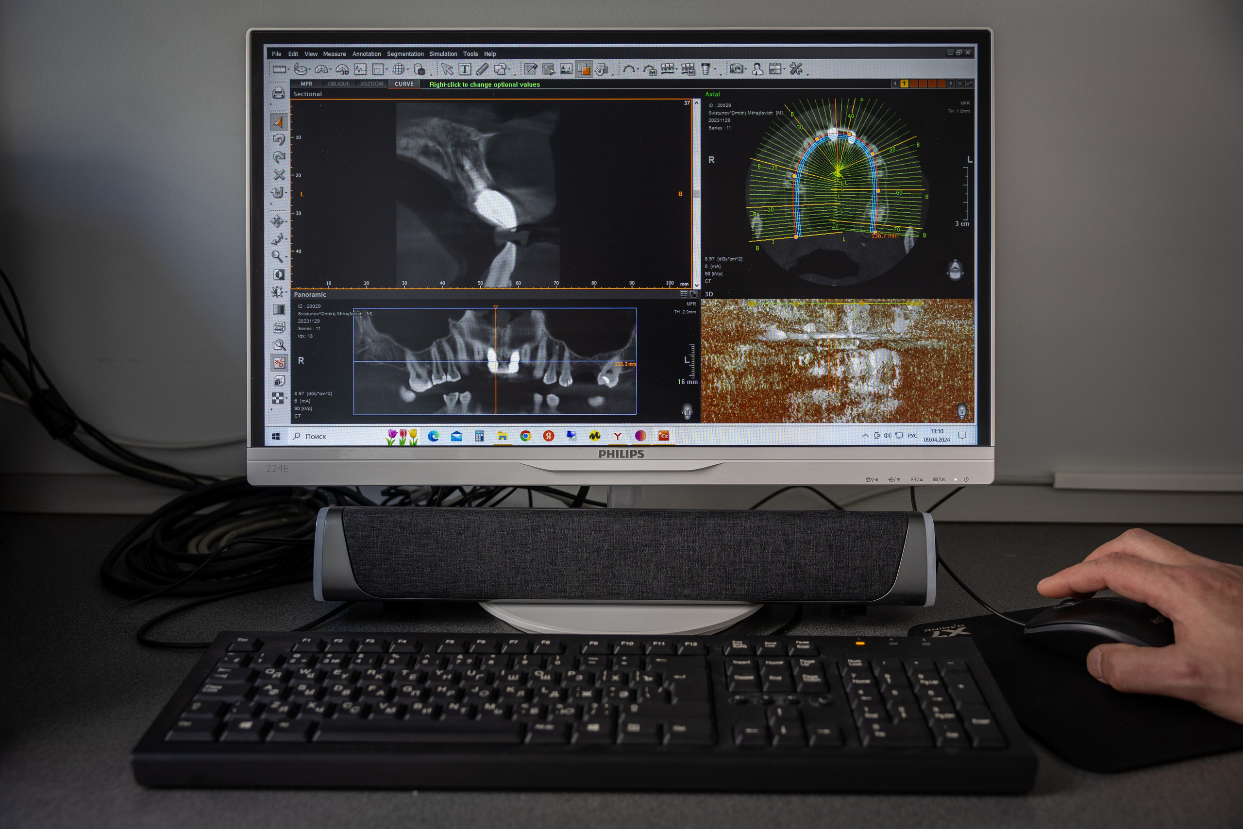 Съемка контента для стоматологии, фото сотрудников, интерьер. Свадебная, репортажная и бизнес съёмка в Ростове-на-Дону