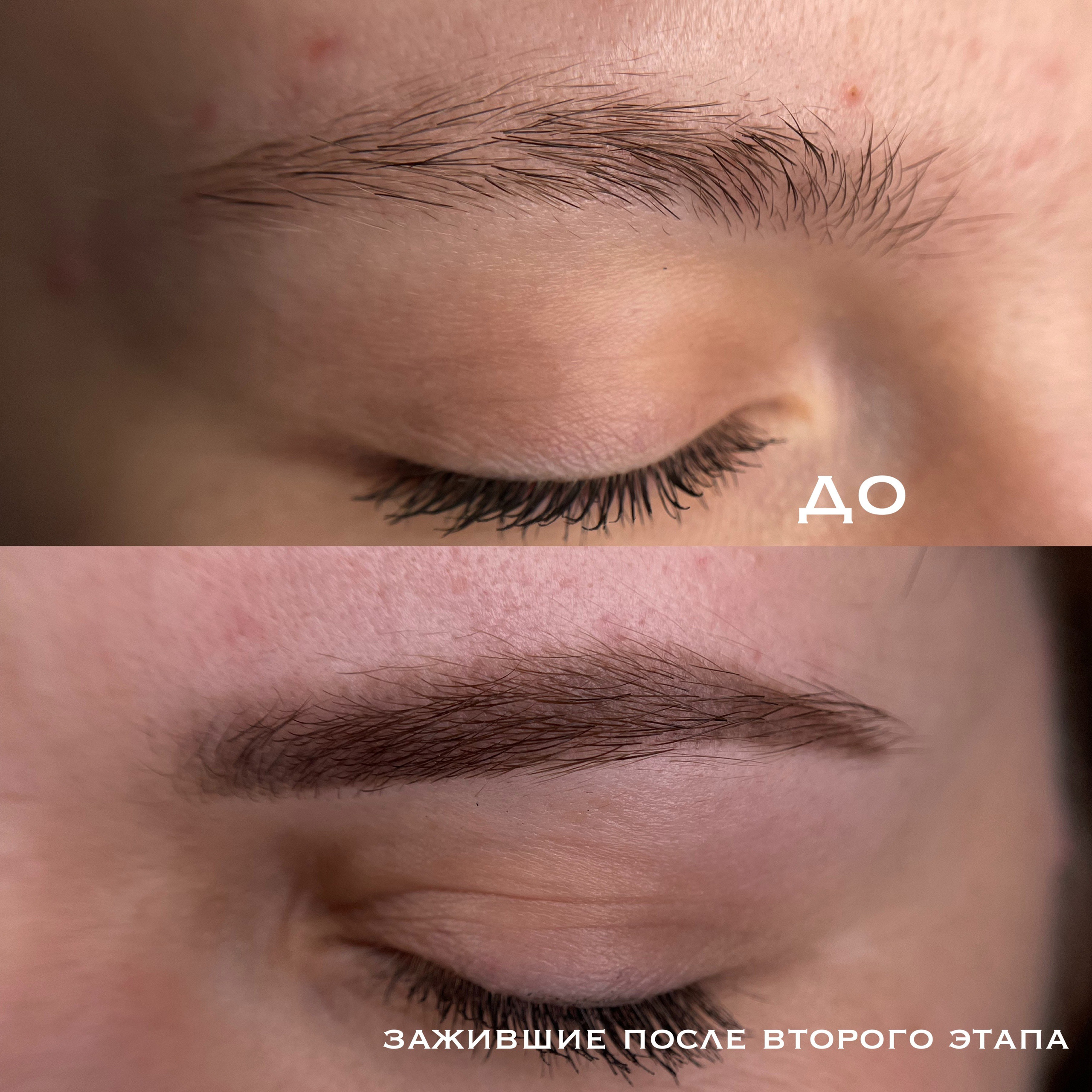 БРОВИ зажившие. Перманентный макияж и удаление старого татуажа в Ростове-на-Дону Дарья Исакова