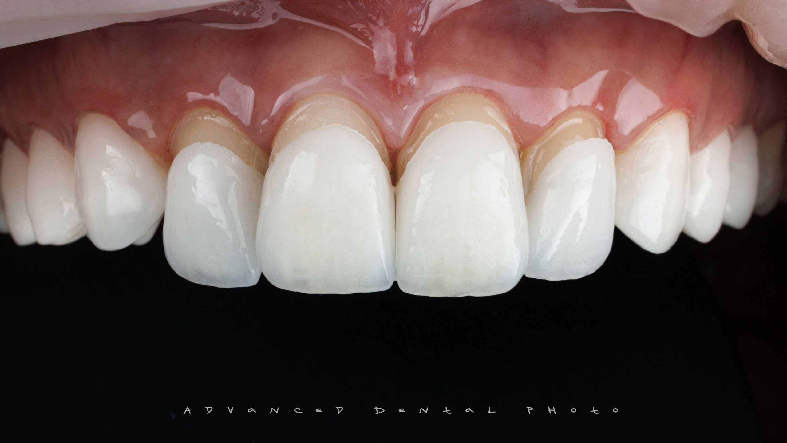 Ортопедия. Дентал фотограф — видеограф Денис Дорошенко