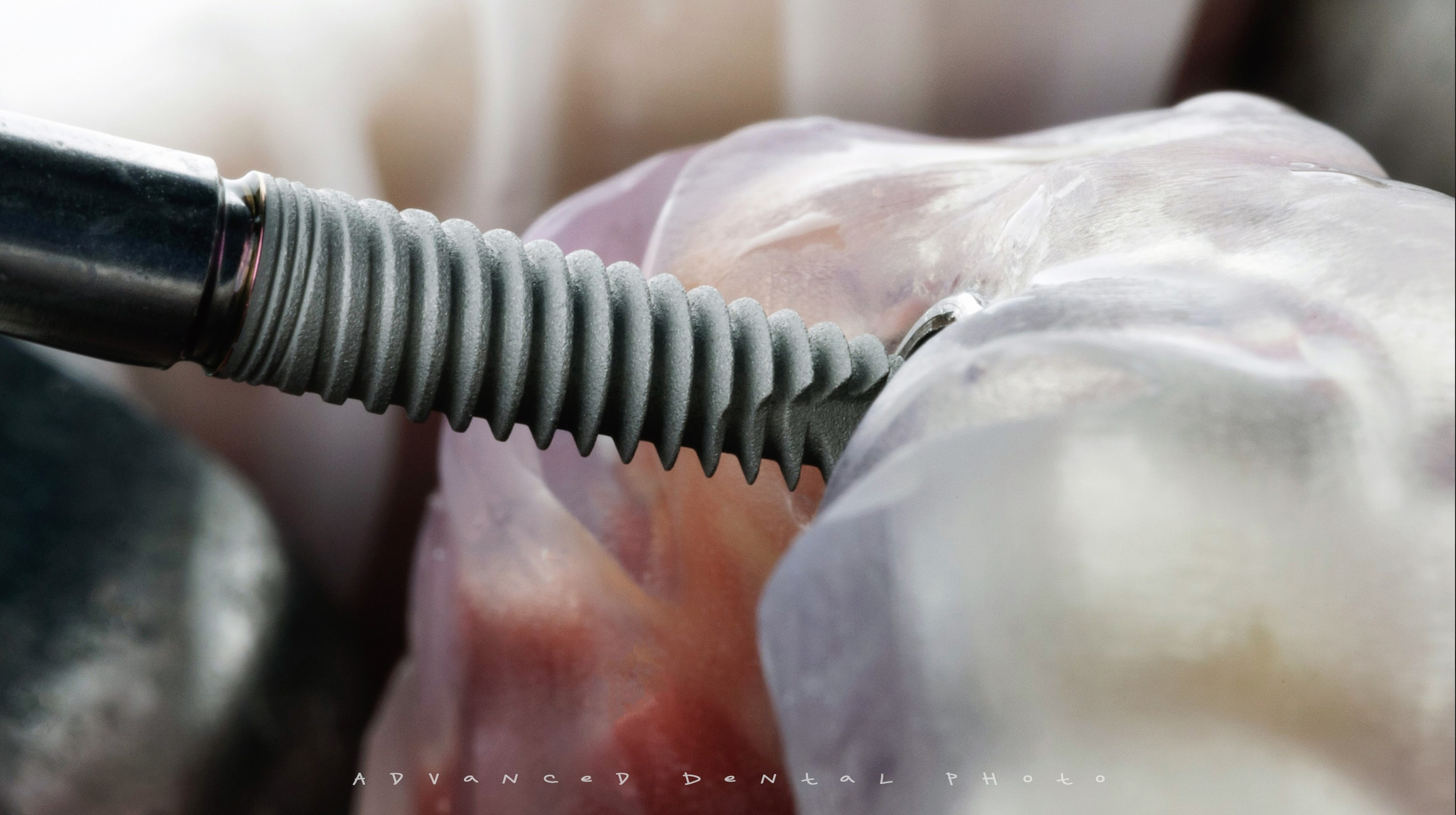 Хирургия. Дентал фотограф — видеограф Денис Дорошенко