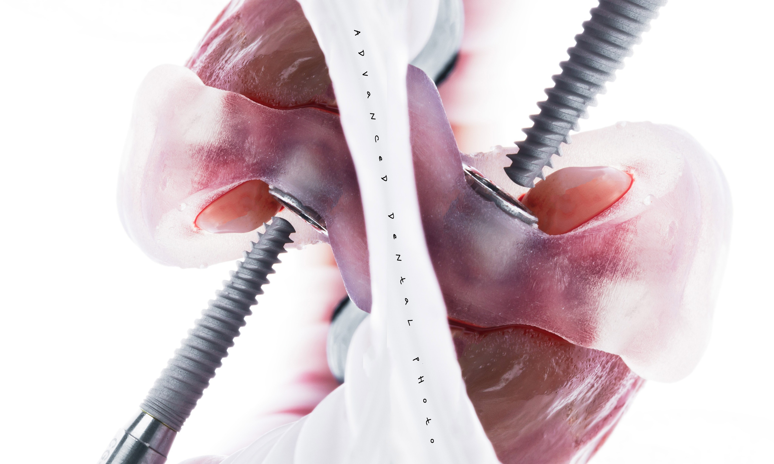 Арт. Дентал фотограф — видеограф Денис Дорошенко