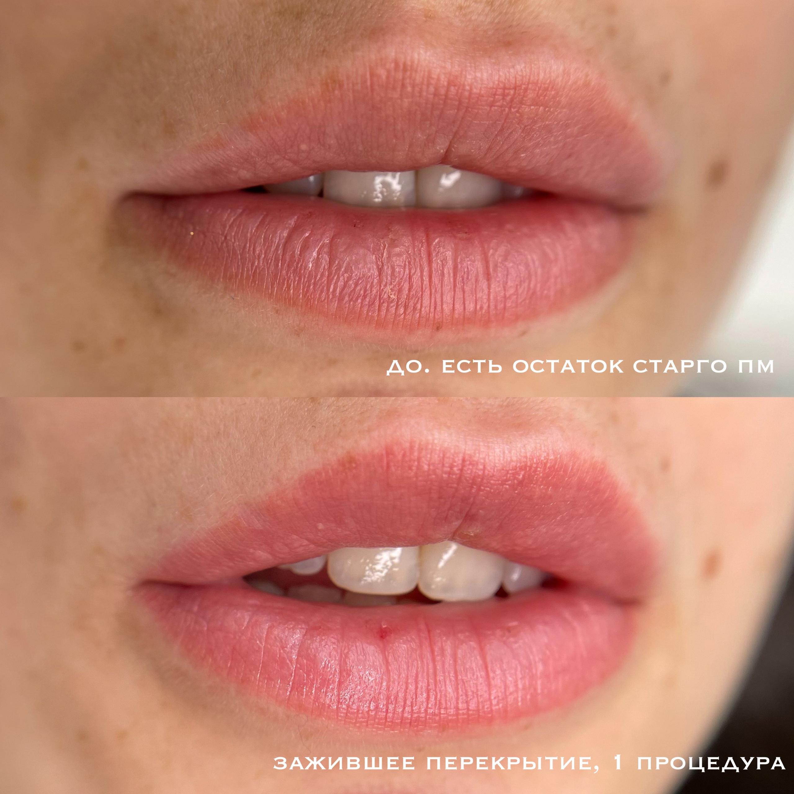 ГУБЫ зажившие. Перманентный макияж и удаление старого татуажа в Ростове-на-Дону Дарья Исакова