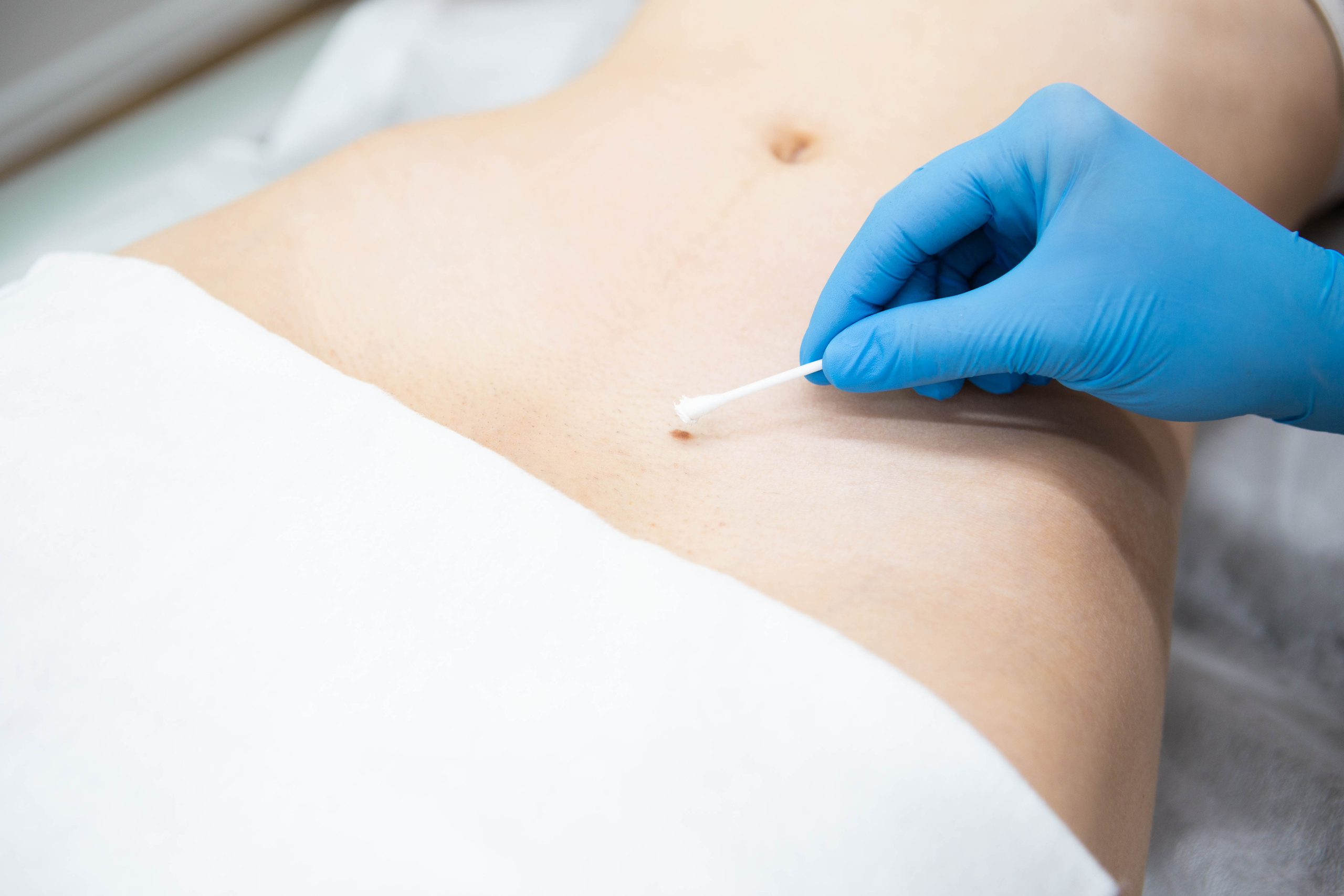 Epilab.studio | Студия лазерной эпиляции. Фотограф Абакумова Анастасия