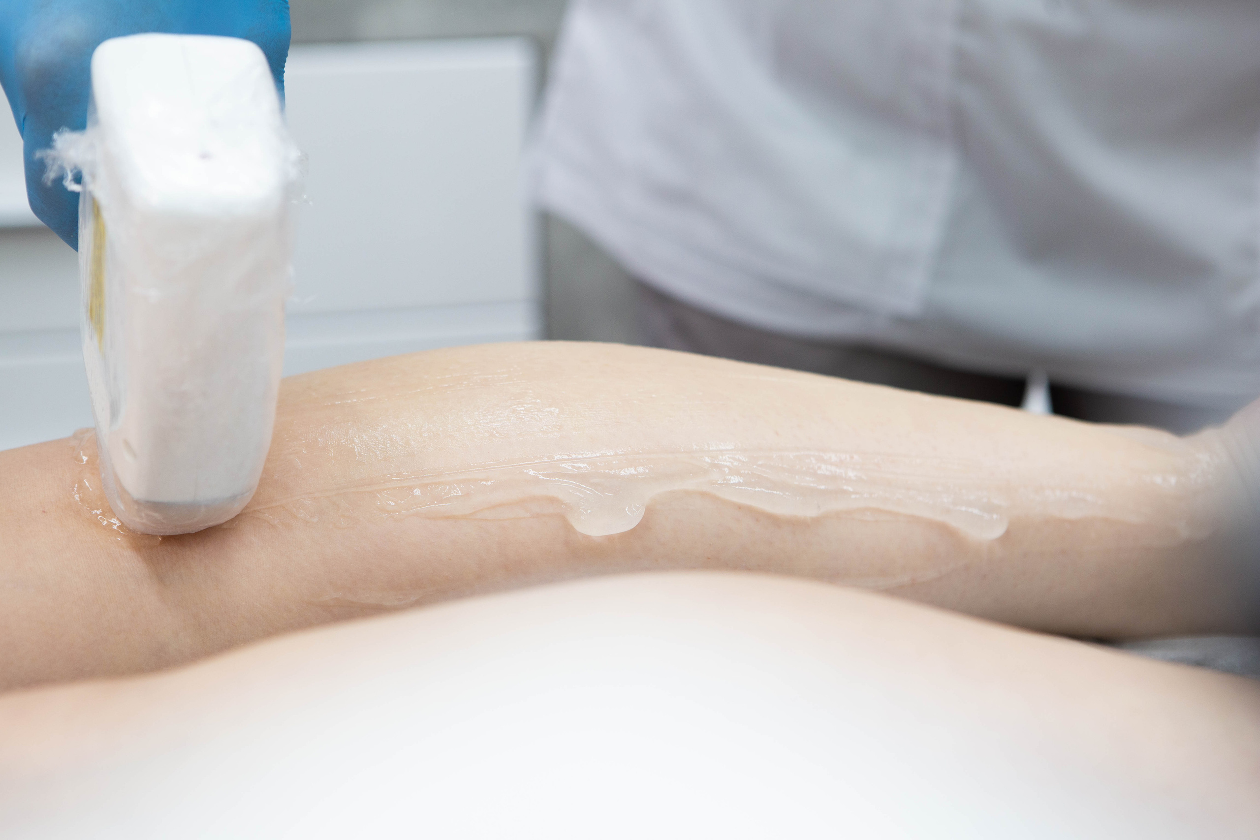 Epilab.studio | Студия лазерной эпиляции. Фотограф Абакумова Анастасия