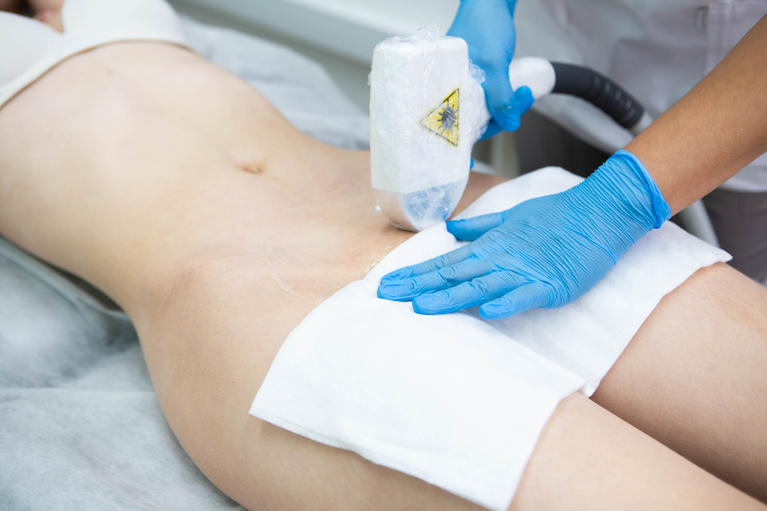 Epilab.studio | Студия лазерной эпиляции. Фотограф Абакумова Анастасия