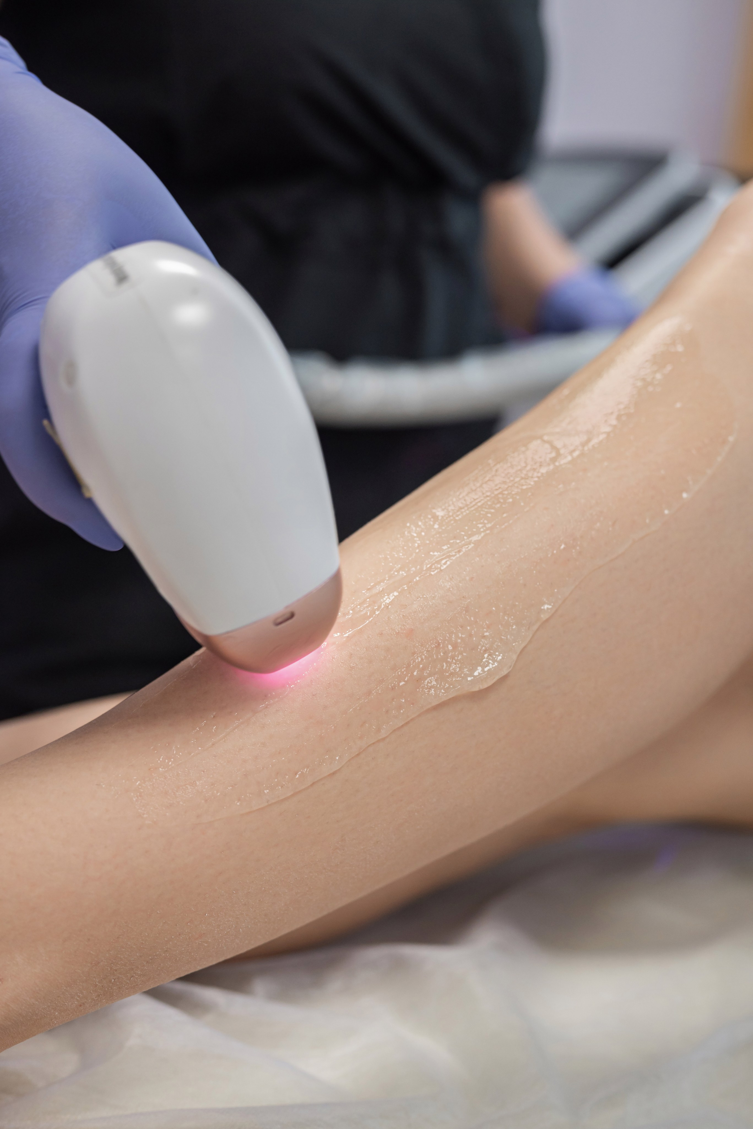 Алина. Мастер лазерной эпиляции. Фотограф в городе Салават