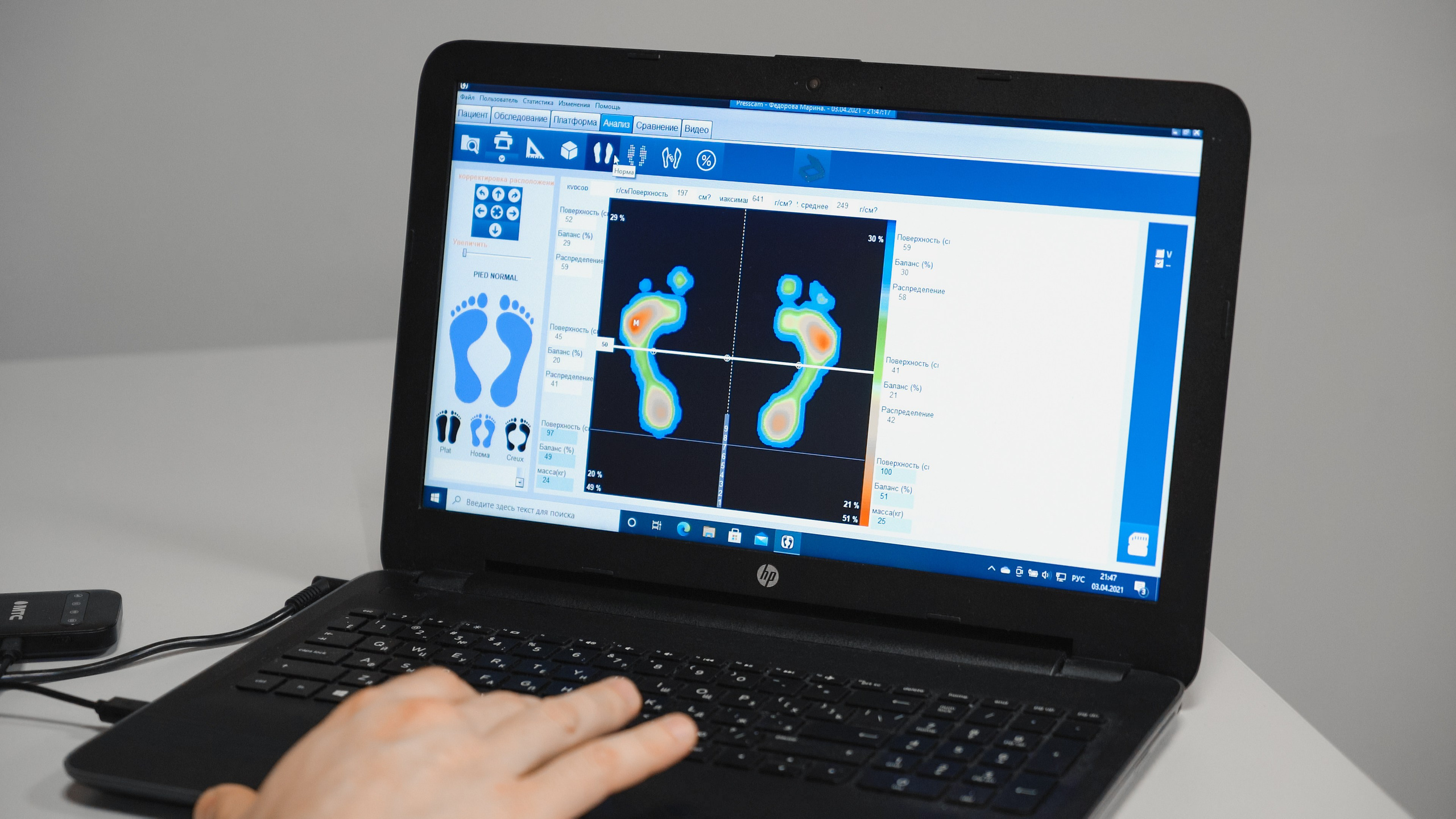 Ортопедические стельки Москва Medical Fitness