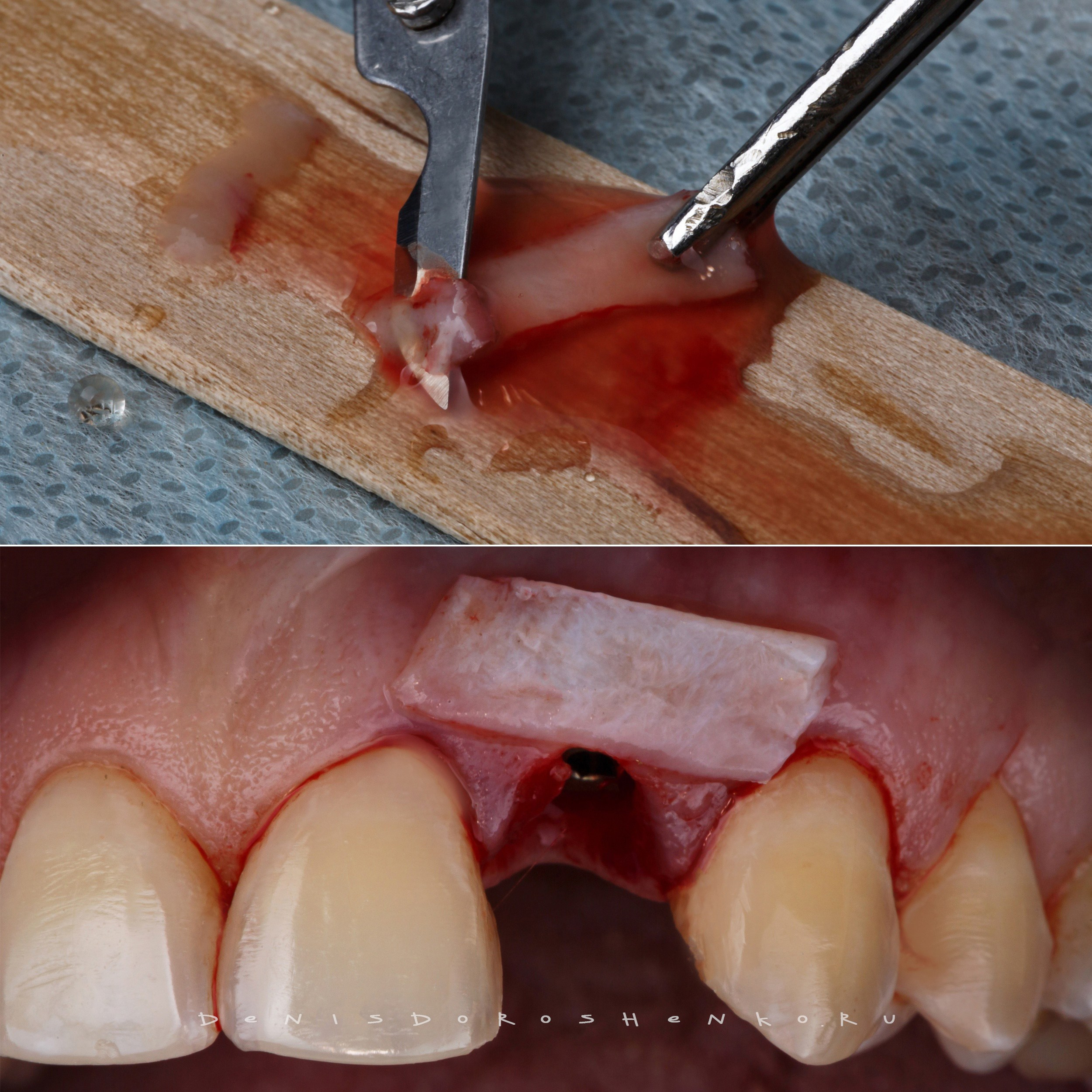 Хирургия. Дентал фотограф — видеограф Денис Дорошенко