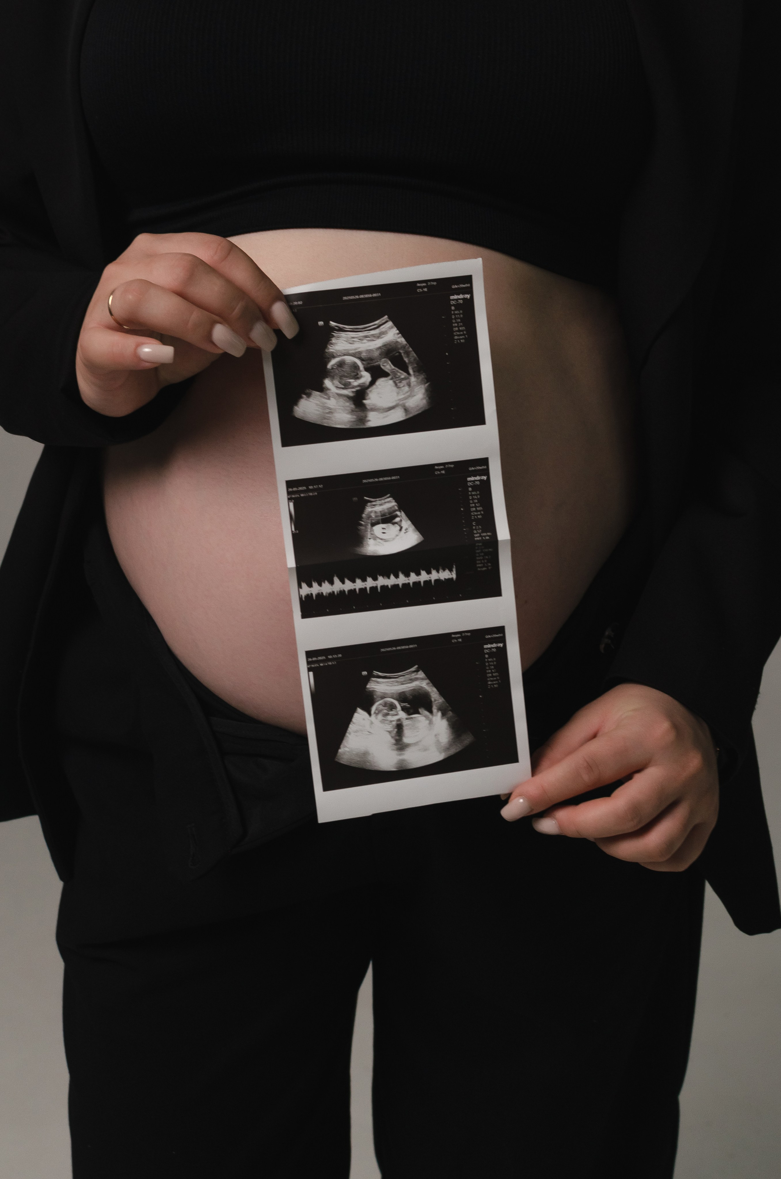 Беременность. Фотограф и контент-мейкер Пинск