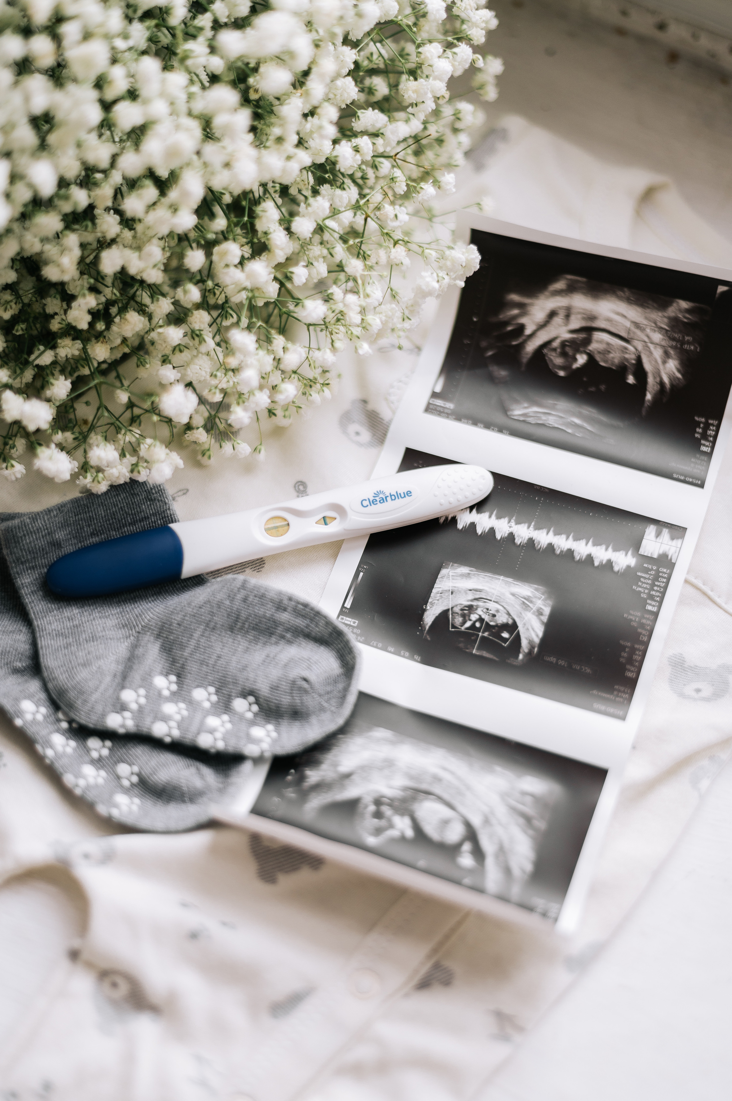 Фотосессия беременности Алихана и Кати. Фотограф в Москве и Московской области Таня Яблочкина