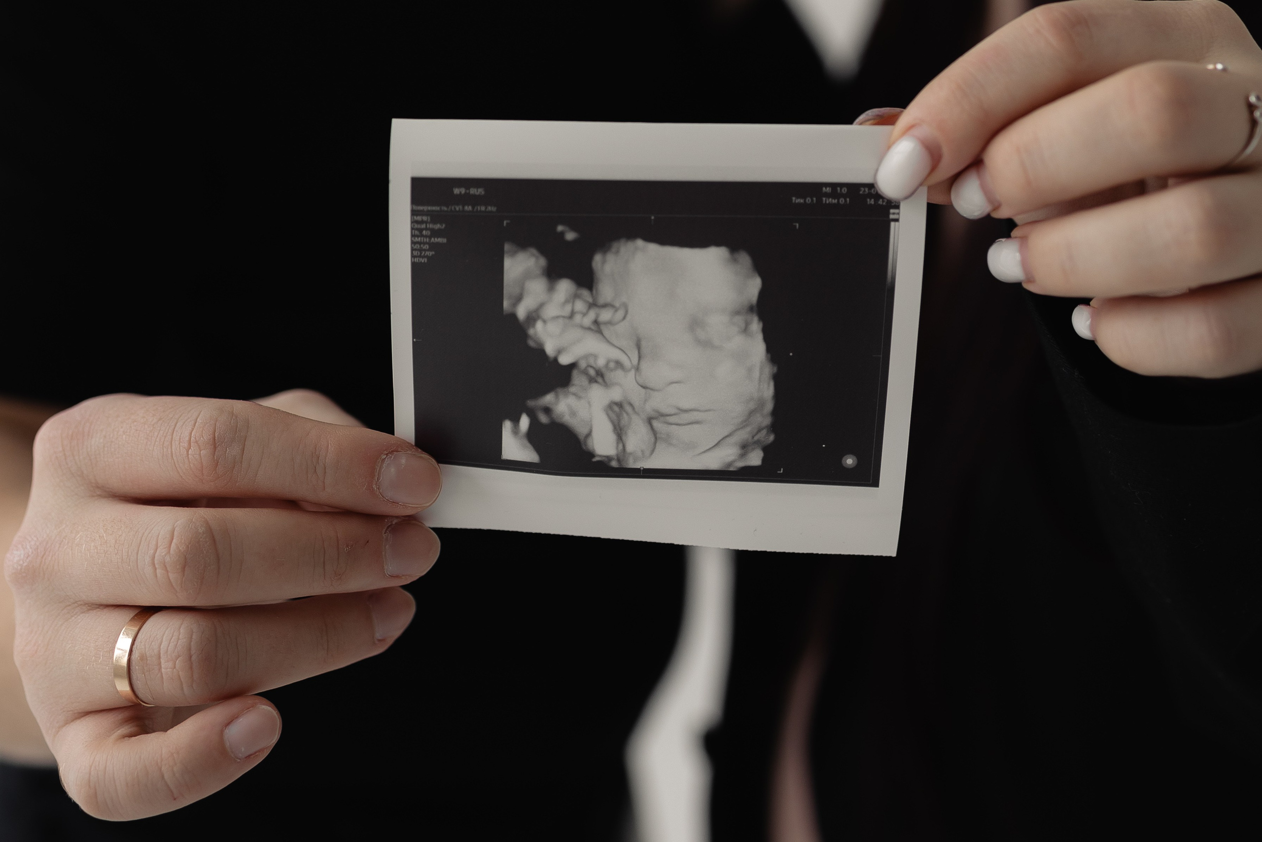 Адель & Динара. Свадебный фотограф Казань| Фотограф Казань Зевакина Анастасия